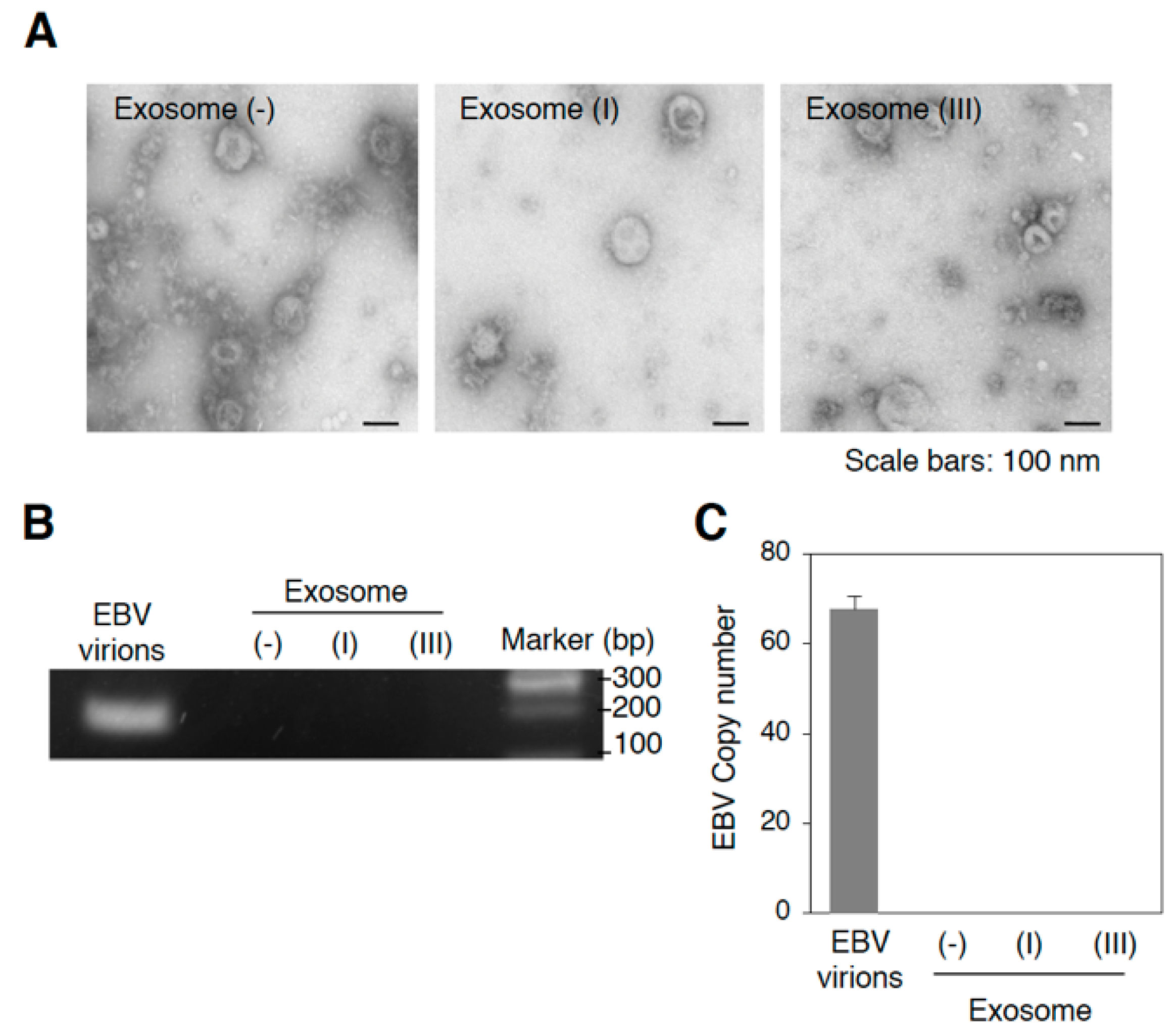 Cancers | Full-Text | Infection of Epstein–Barr Virus in Type III Latency Modulates Biogenesis Exosomes and the Expression Profile of Exosomal miRNAs in the Burkitt Lymphoma Mutu Cell Lines