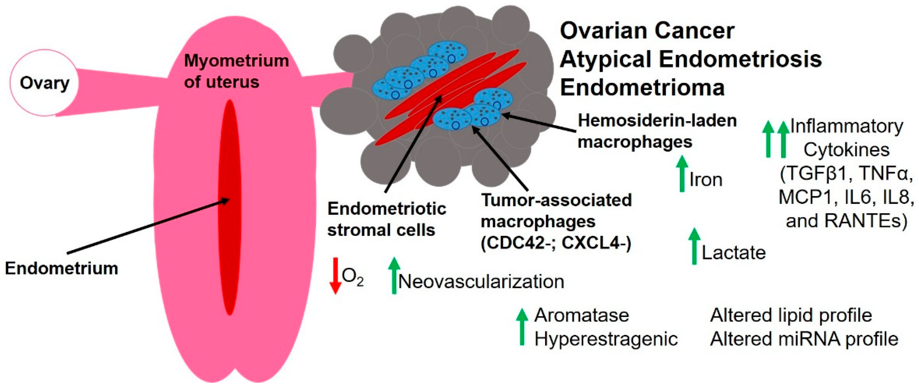 Ovarian cancer endometrial