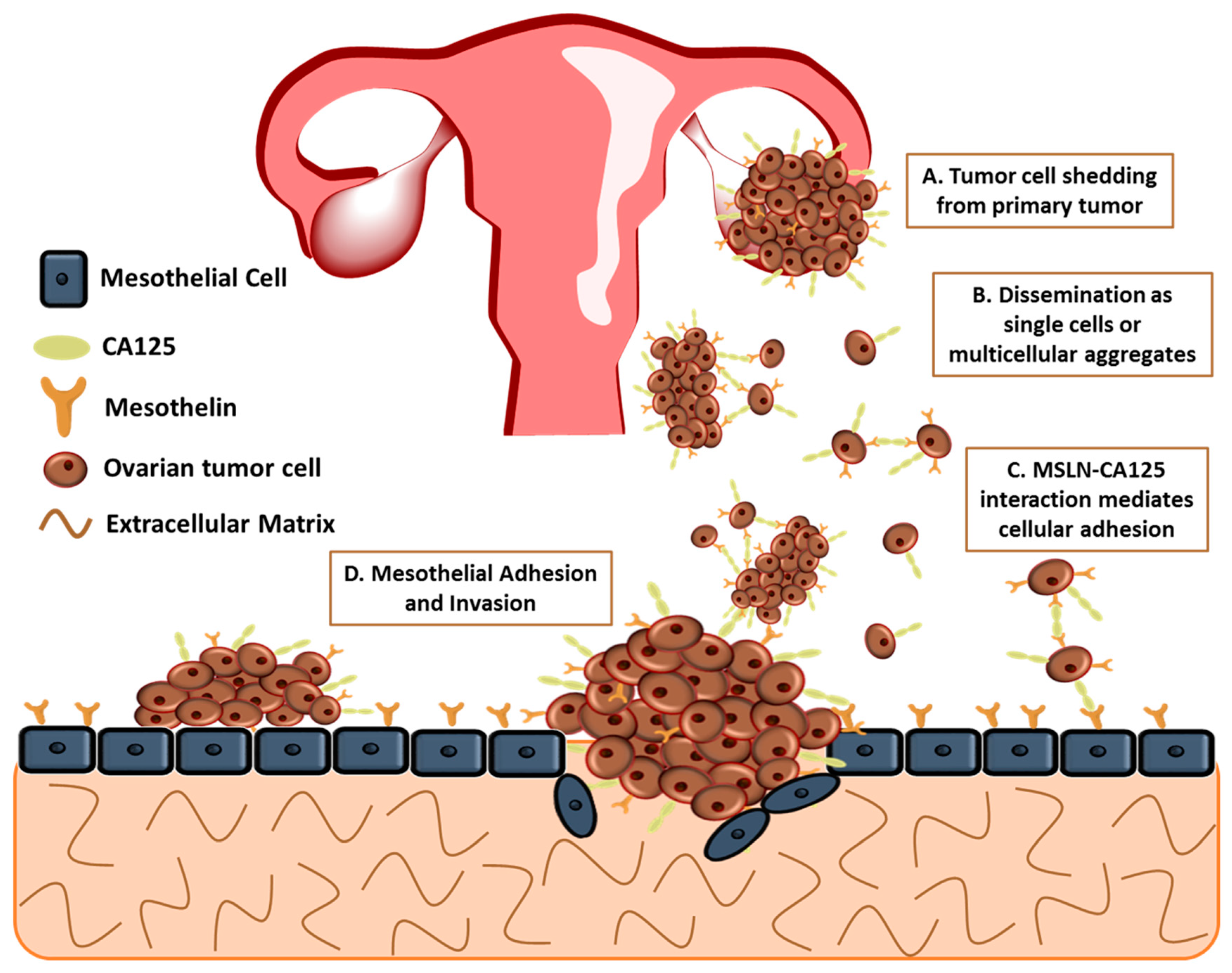 ovarian cancer etiology