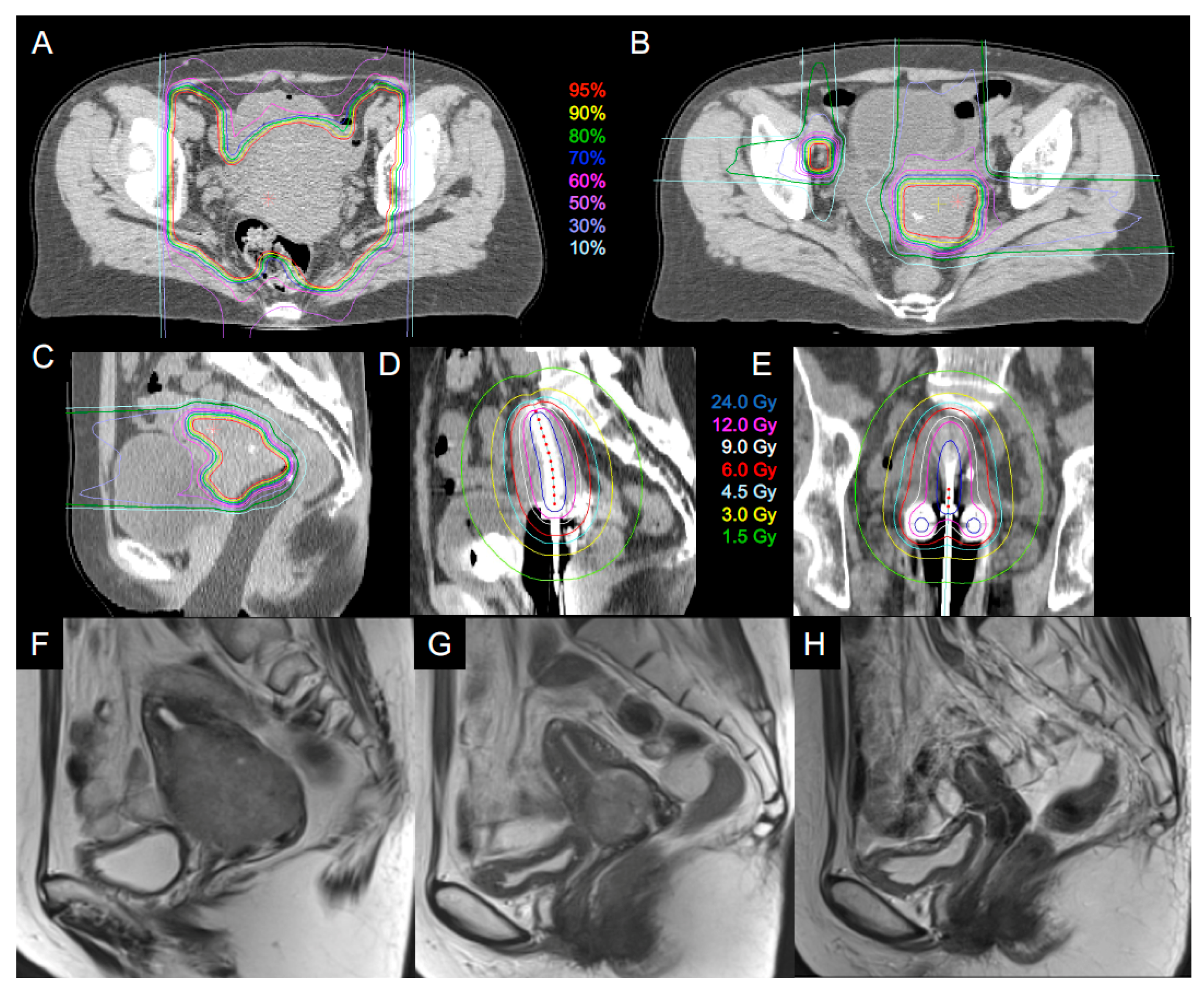 Cancers 10 00338 g001 Cancers 10 00338 g001