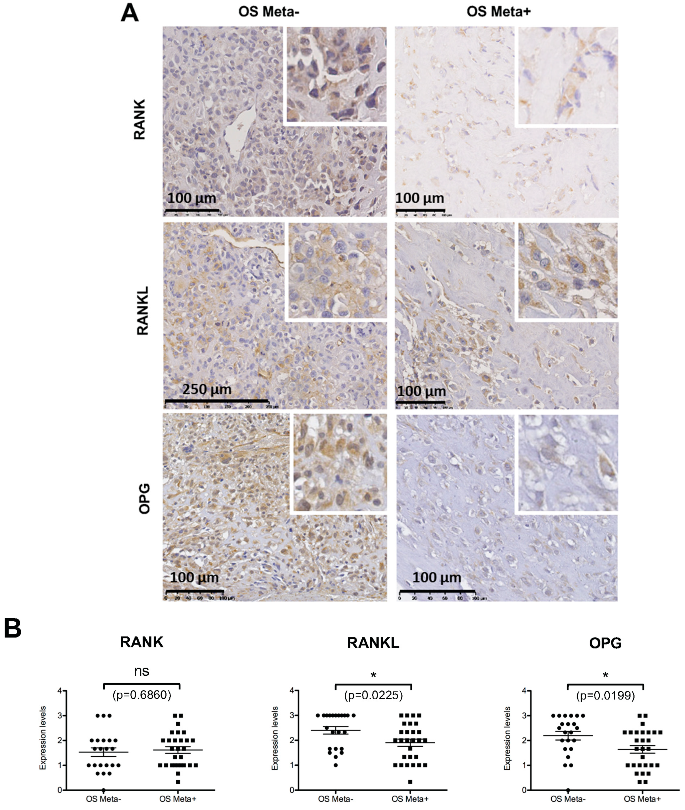 Cancers 10 00398 g005a Cancers 10 00398 g005a
