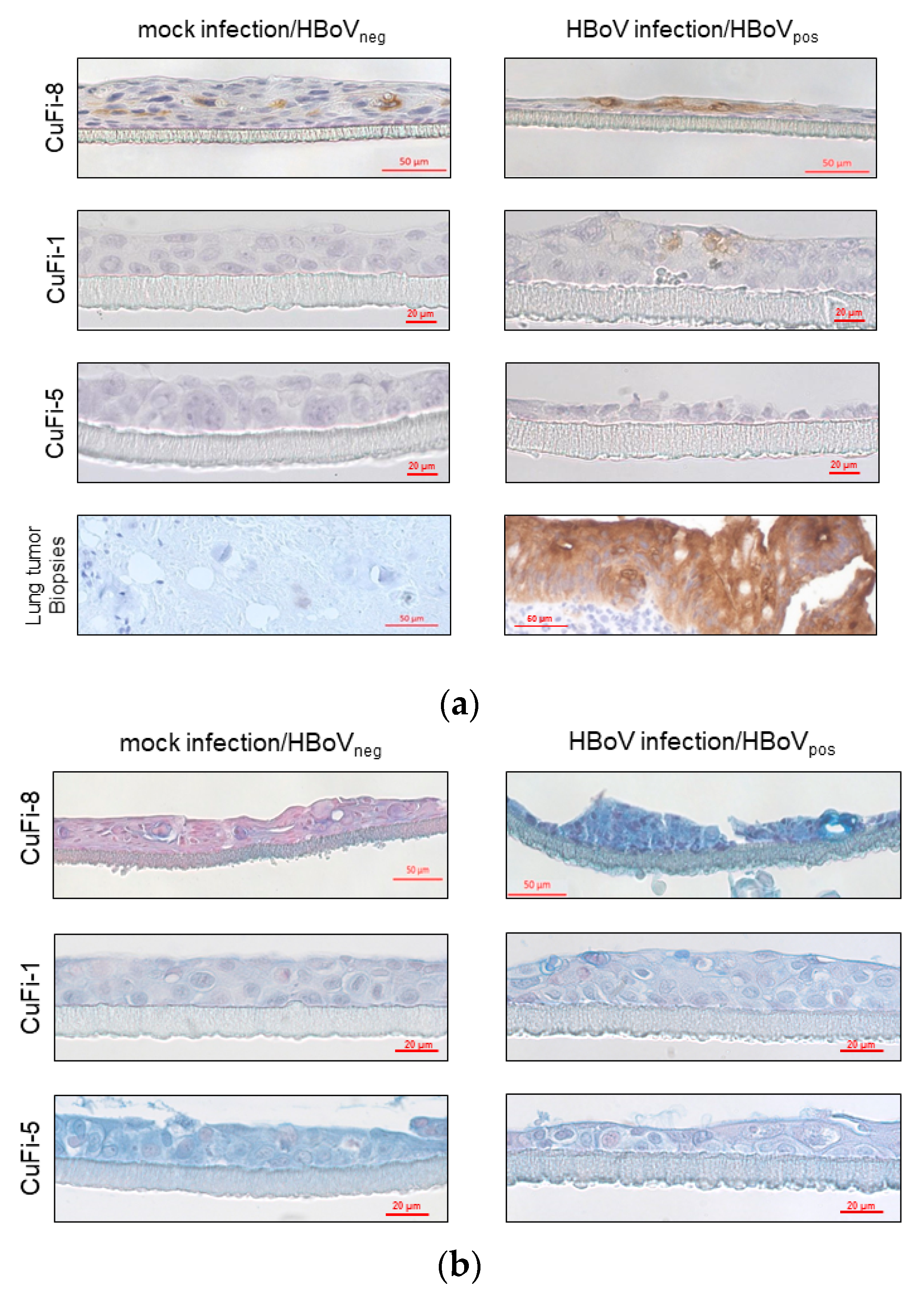 Cancers 10 00410 g003 Cancers 10 00410 g003