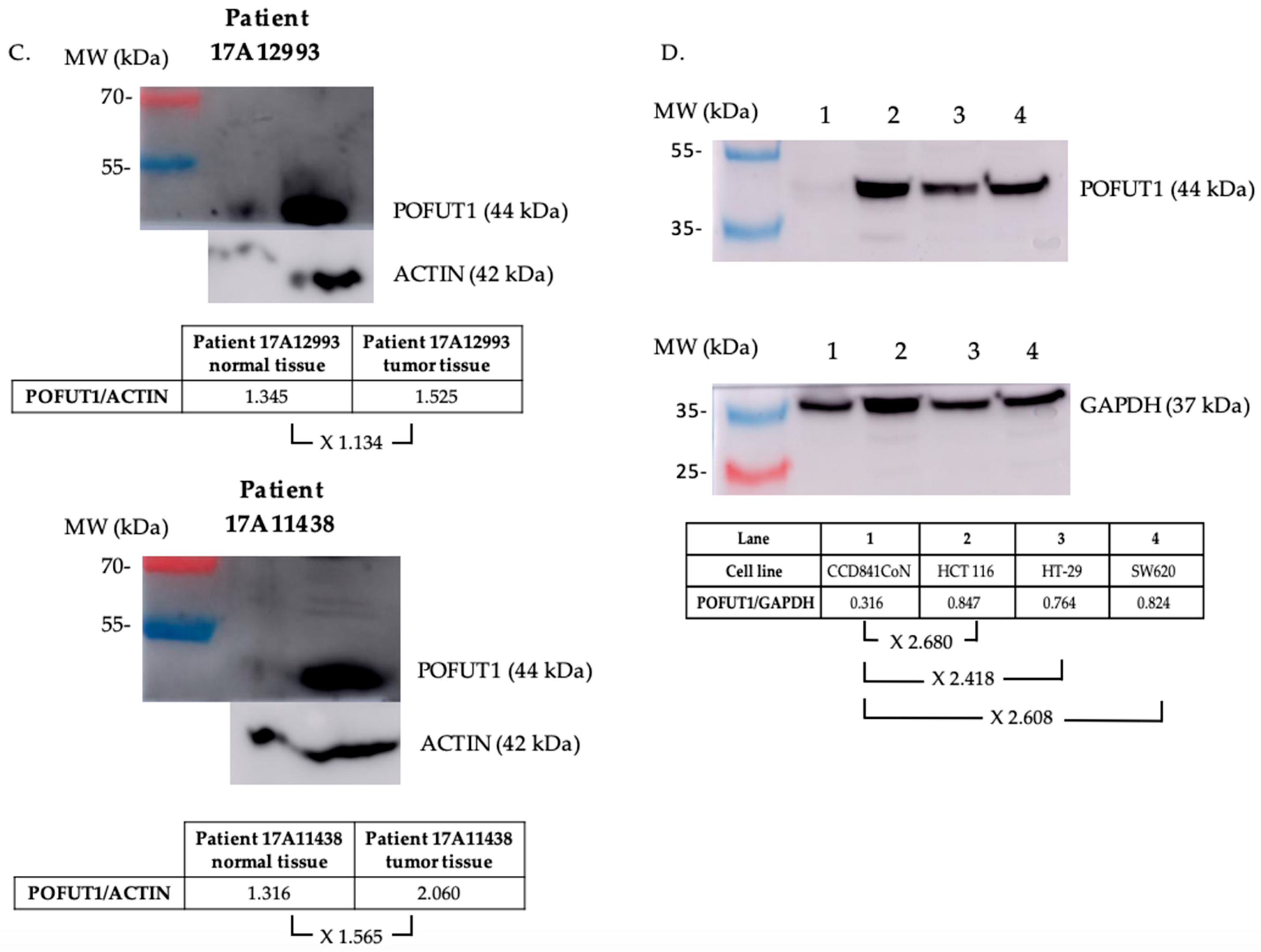 Cancers 10 00411 g002b Cancers 10 00411 g002b