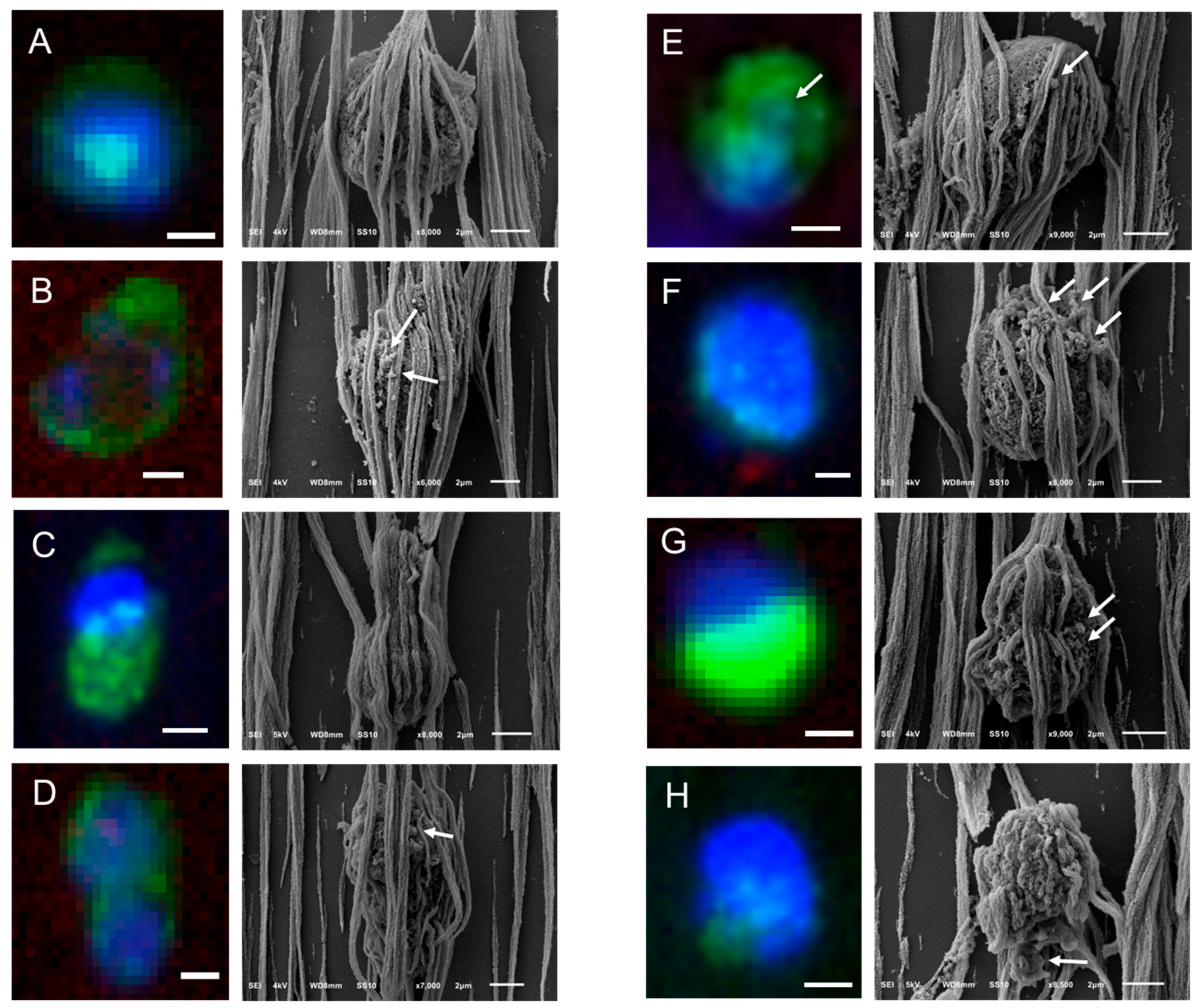 Cancers 10 00416 g004