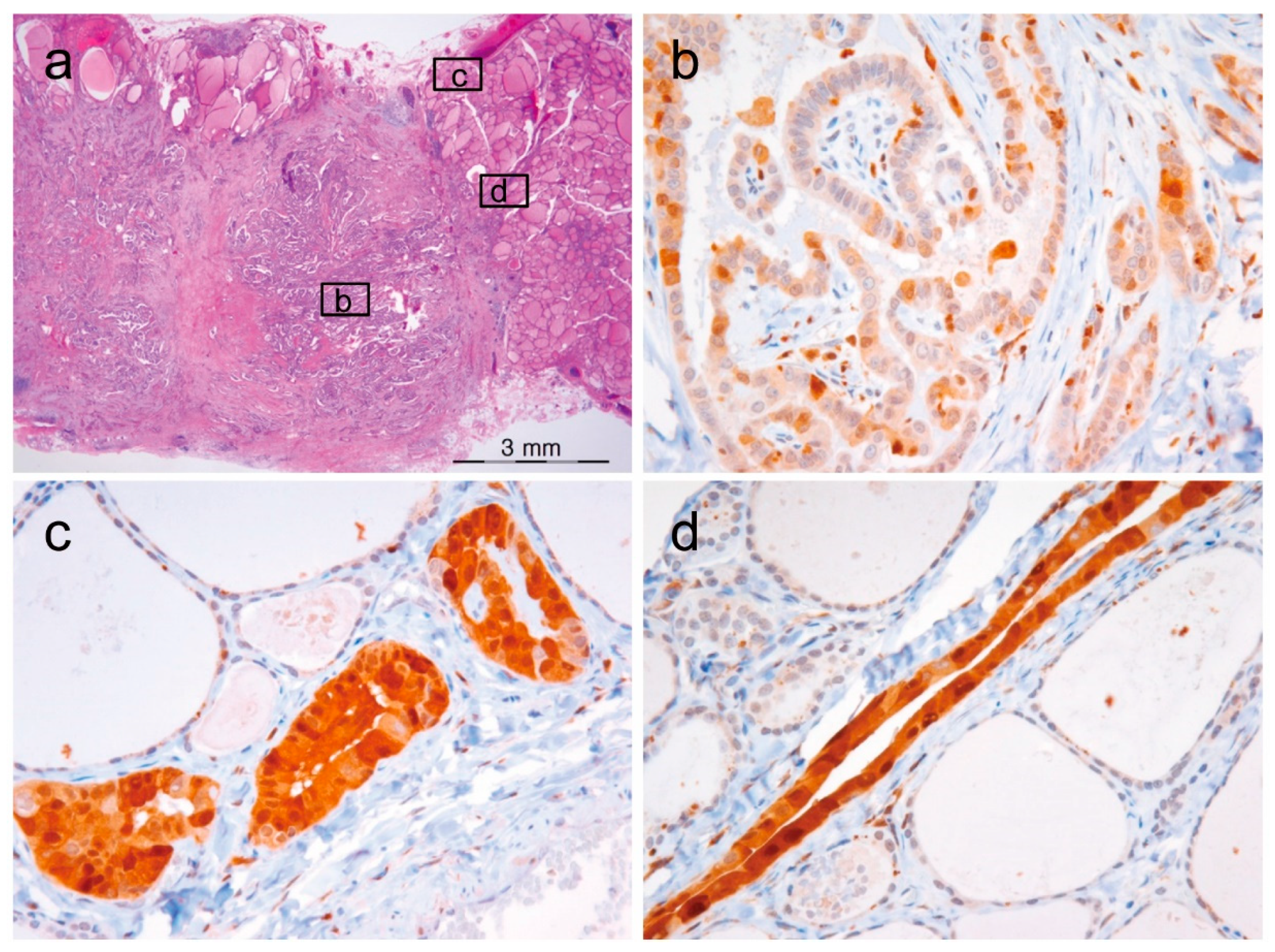 Cancers 10 00437 g004 Cancers 10 00437 g004