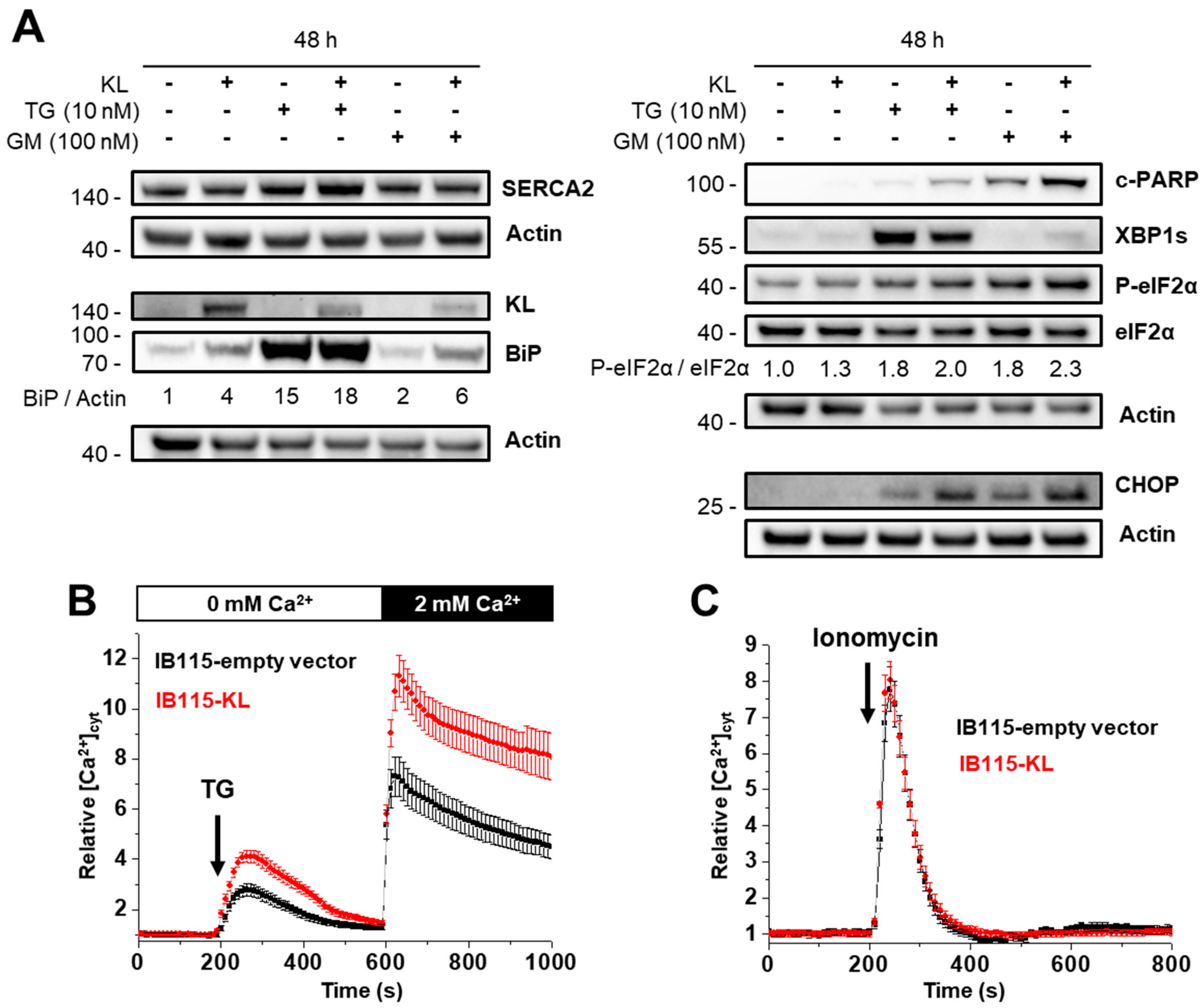 The Role of the Anti Aging Protein Klotho in IGF 1 Signaling and Reticular Calcium Leak Impact on the Chemosensitivity of Dedifferentiated Liposarcomas