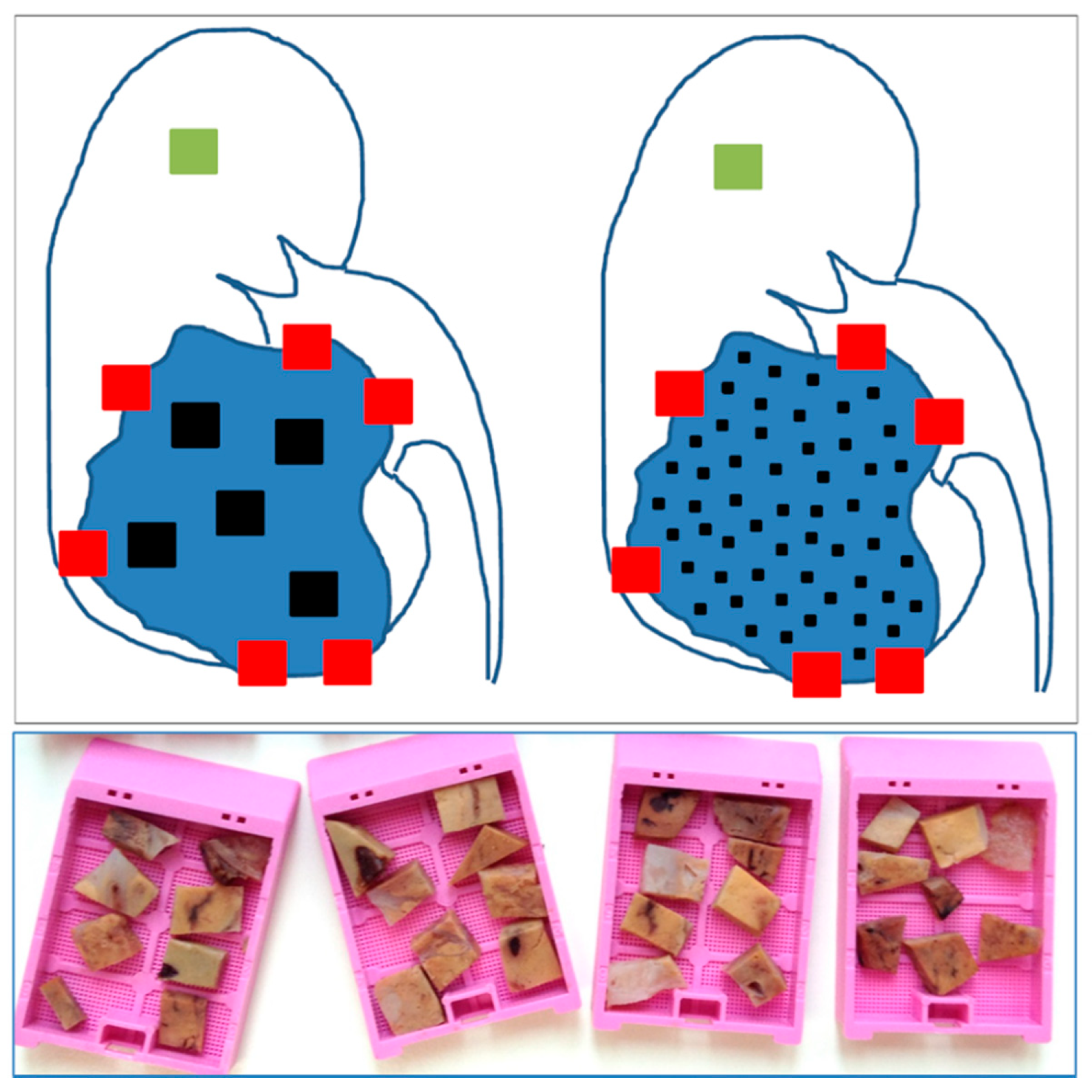 Cancers 10 00485 g001 Cancers 10 00485 g001