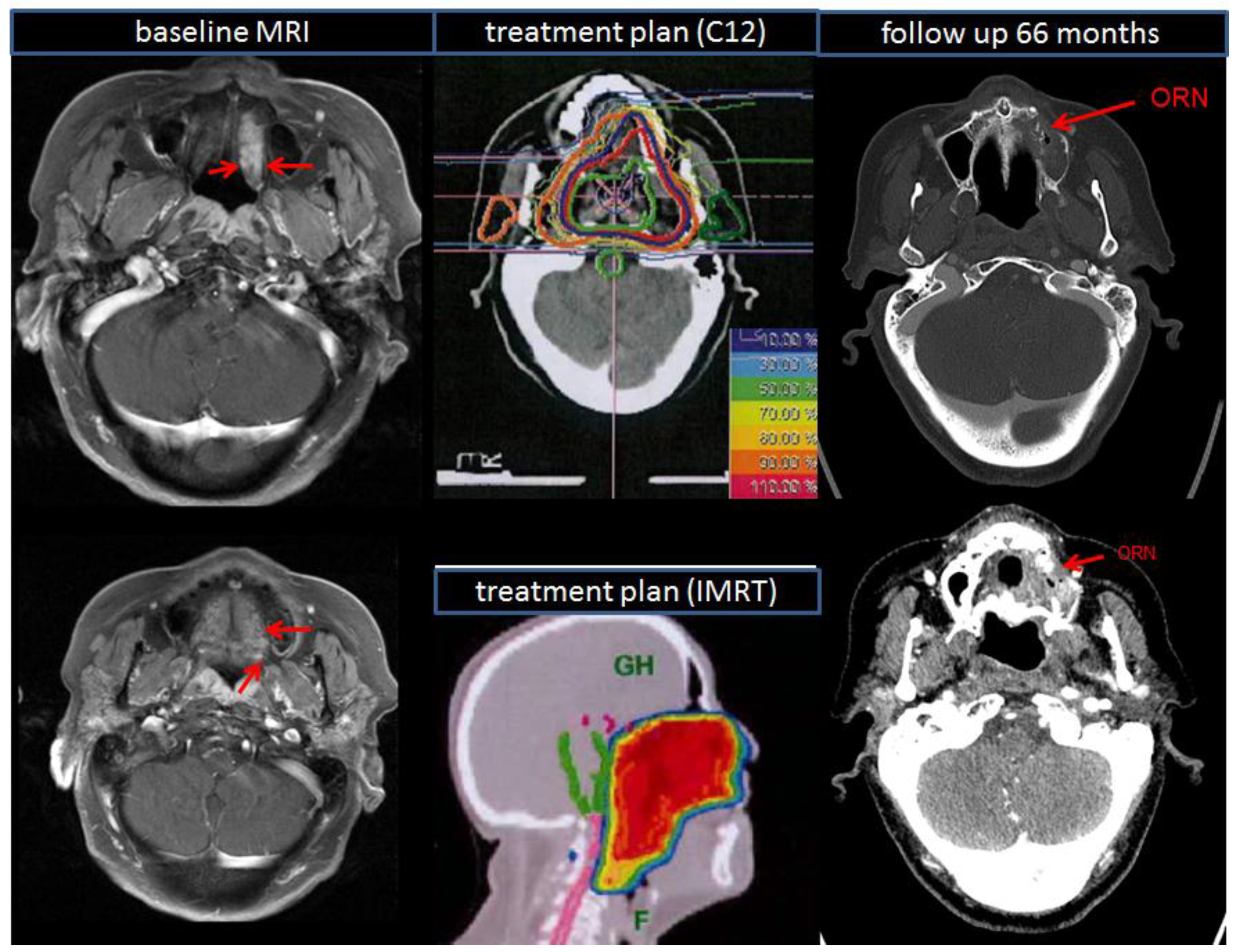 Cancers 10 00488 g004