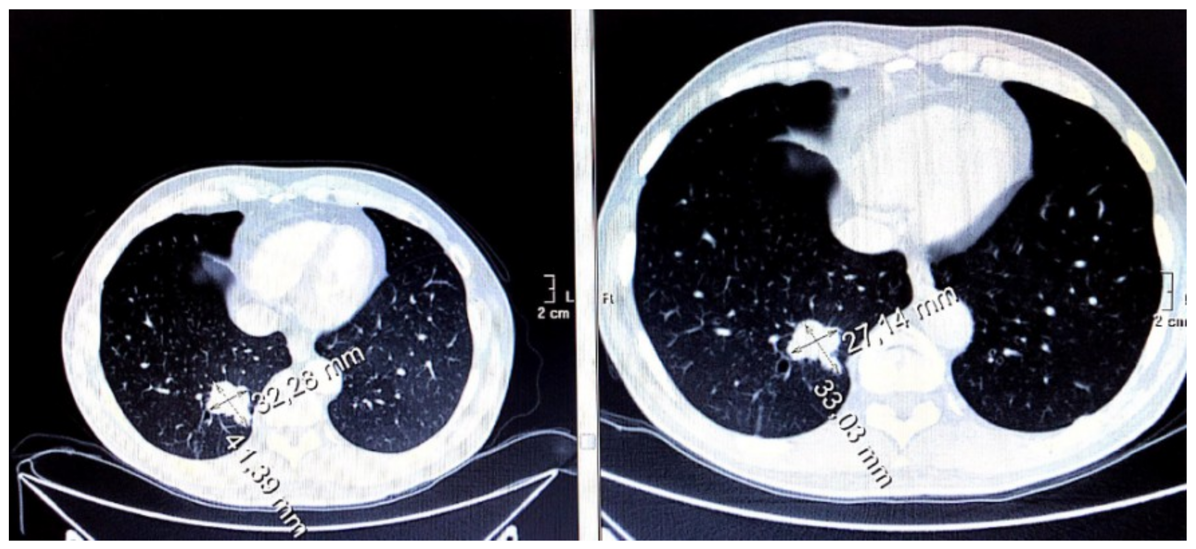Cancers 11 00030 g005 Cancers 11 00030 g005