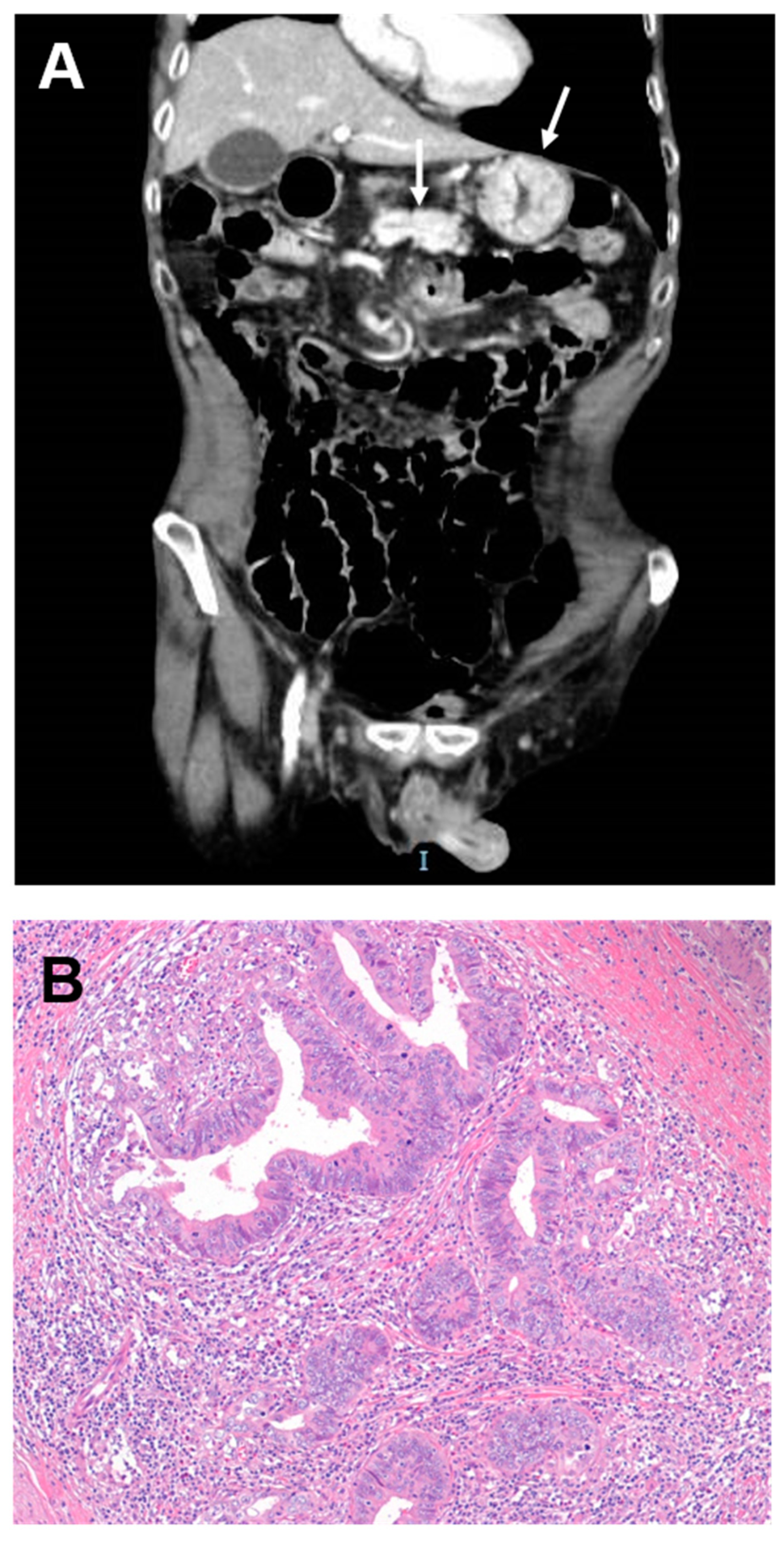 Cancers 11 00031 g002