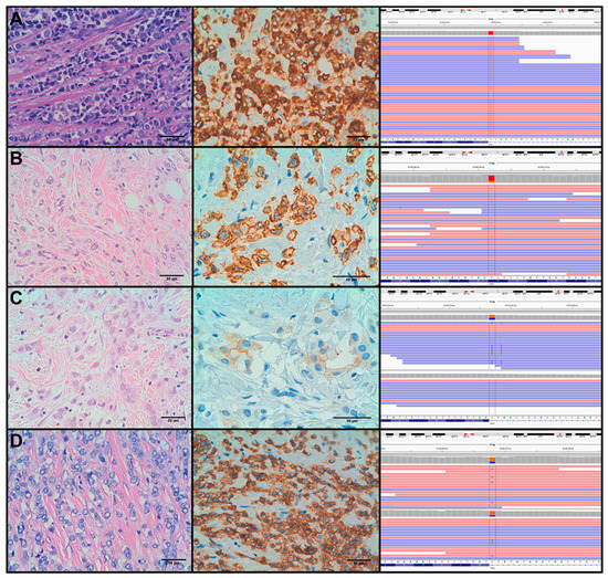 Cancers Free FullText High Frequency of ERBB2 Activating Mutations