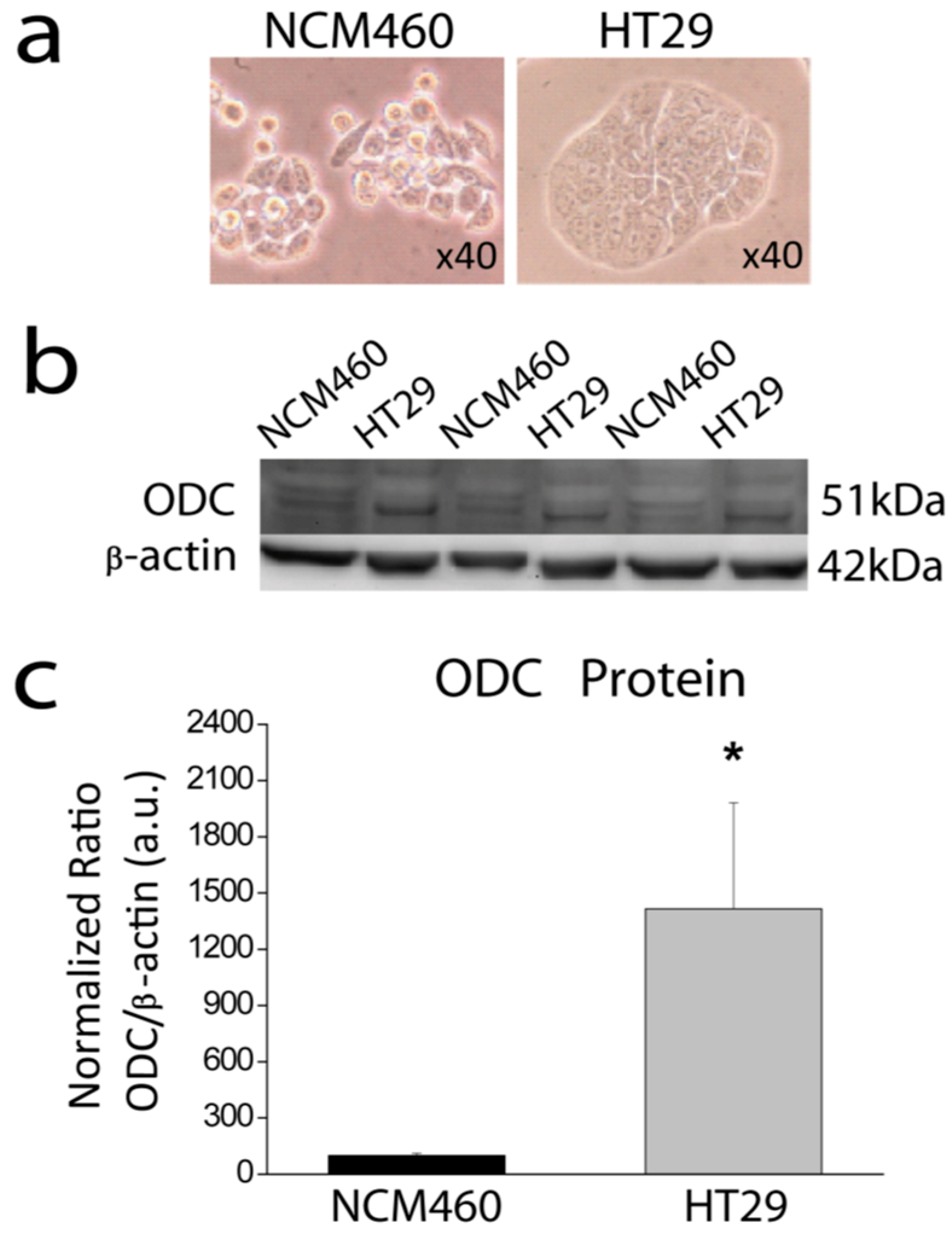 Cancers 11 00083 g001