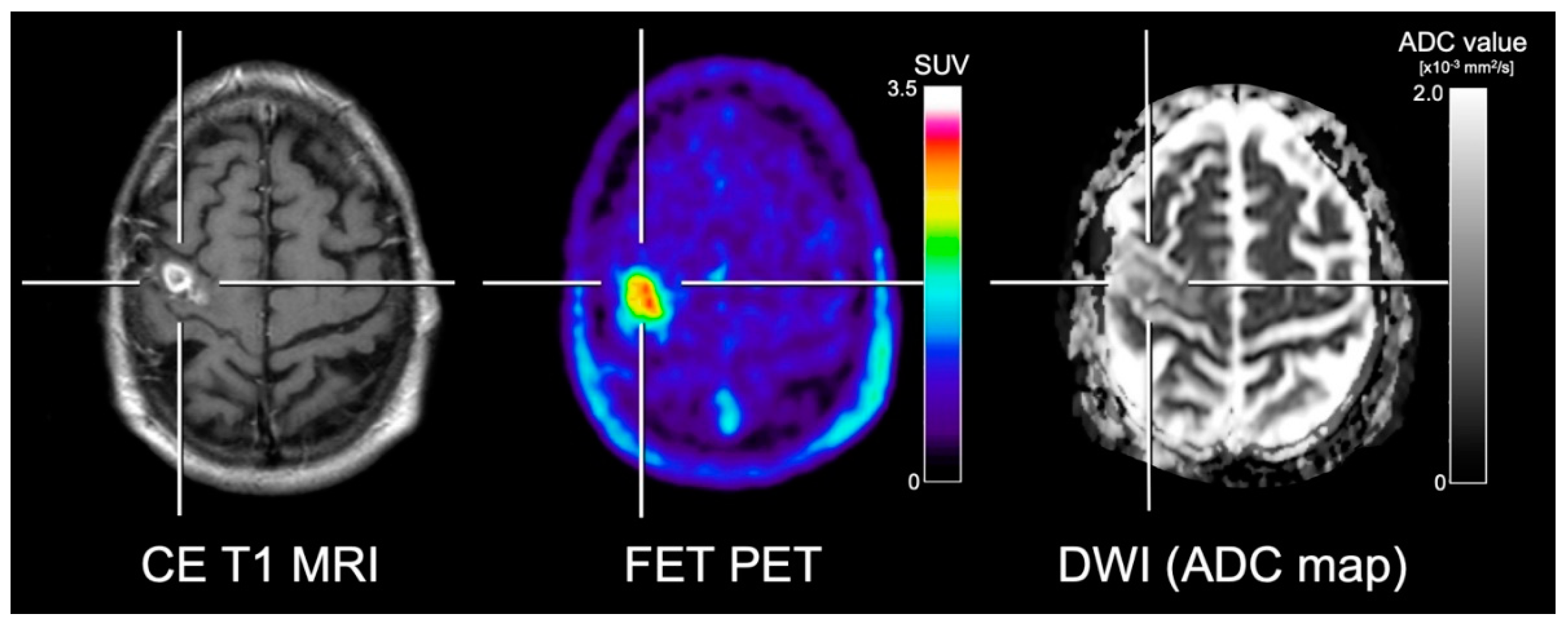 Cancers 11 00153 g003 Cancers 11 00153 g003