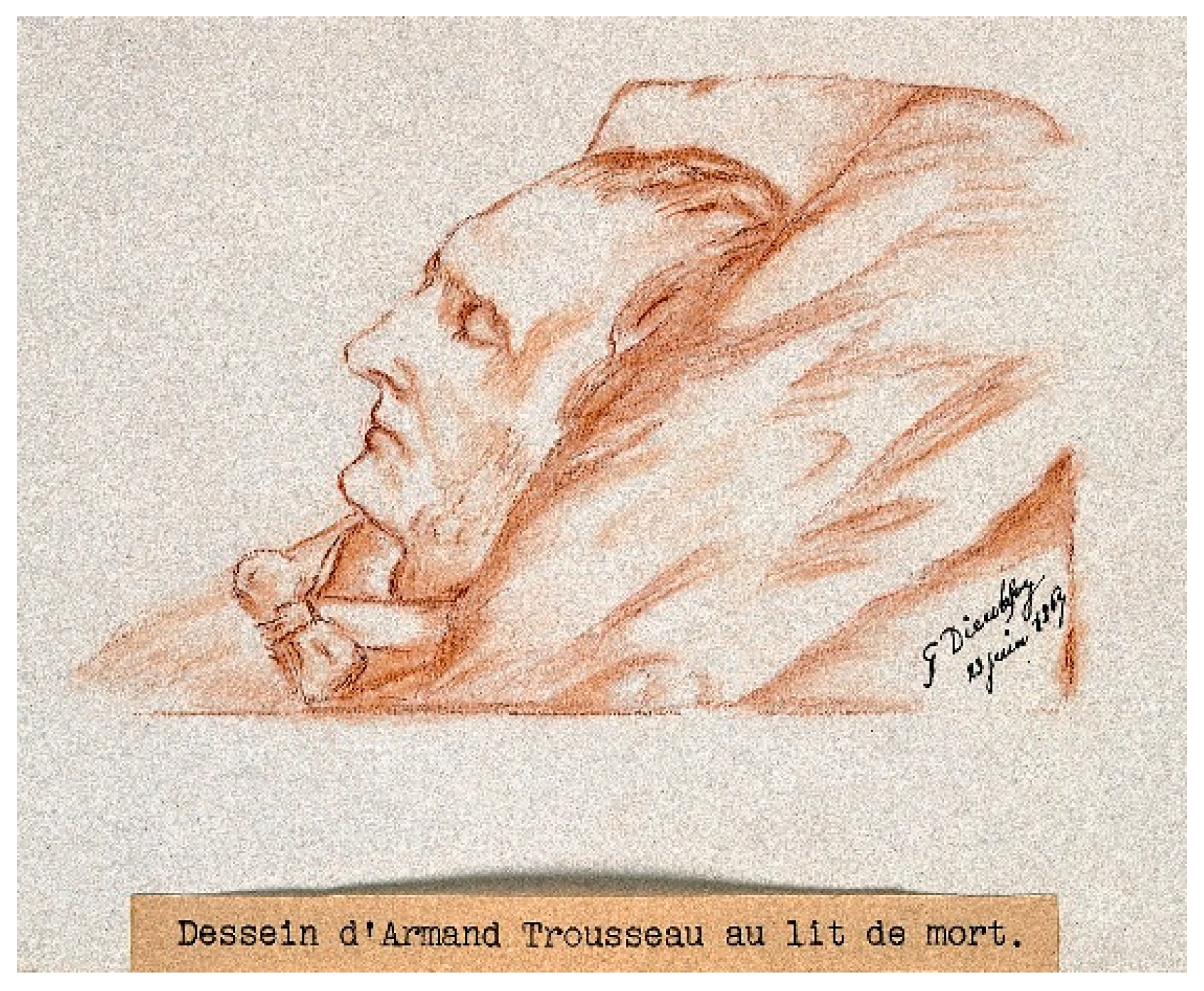 Cancers Free Full Text The History Of Armand Trousseau And Cancer Associated Thrombosis Html