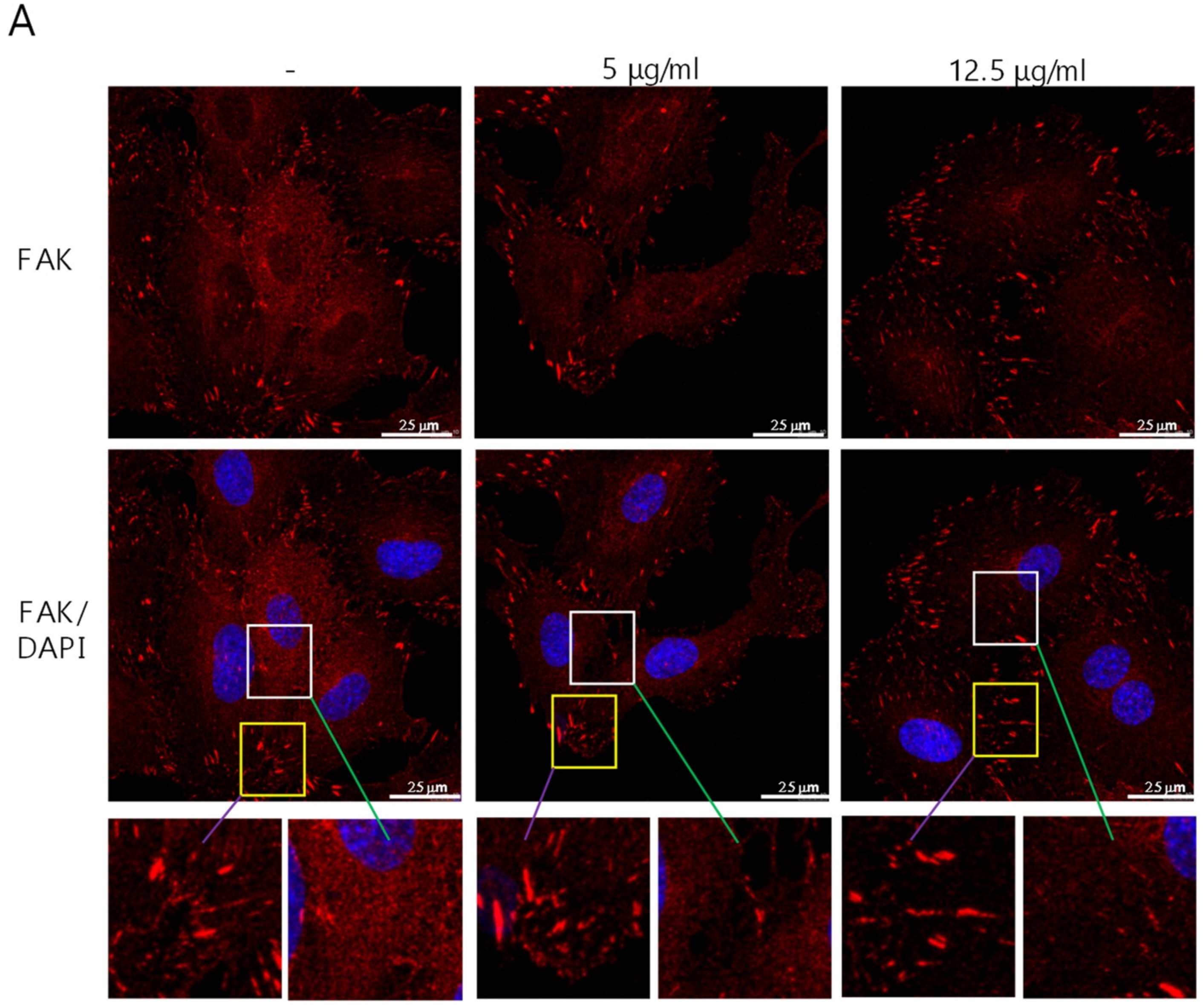 Cancers 11 00168 g004a 550