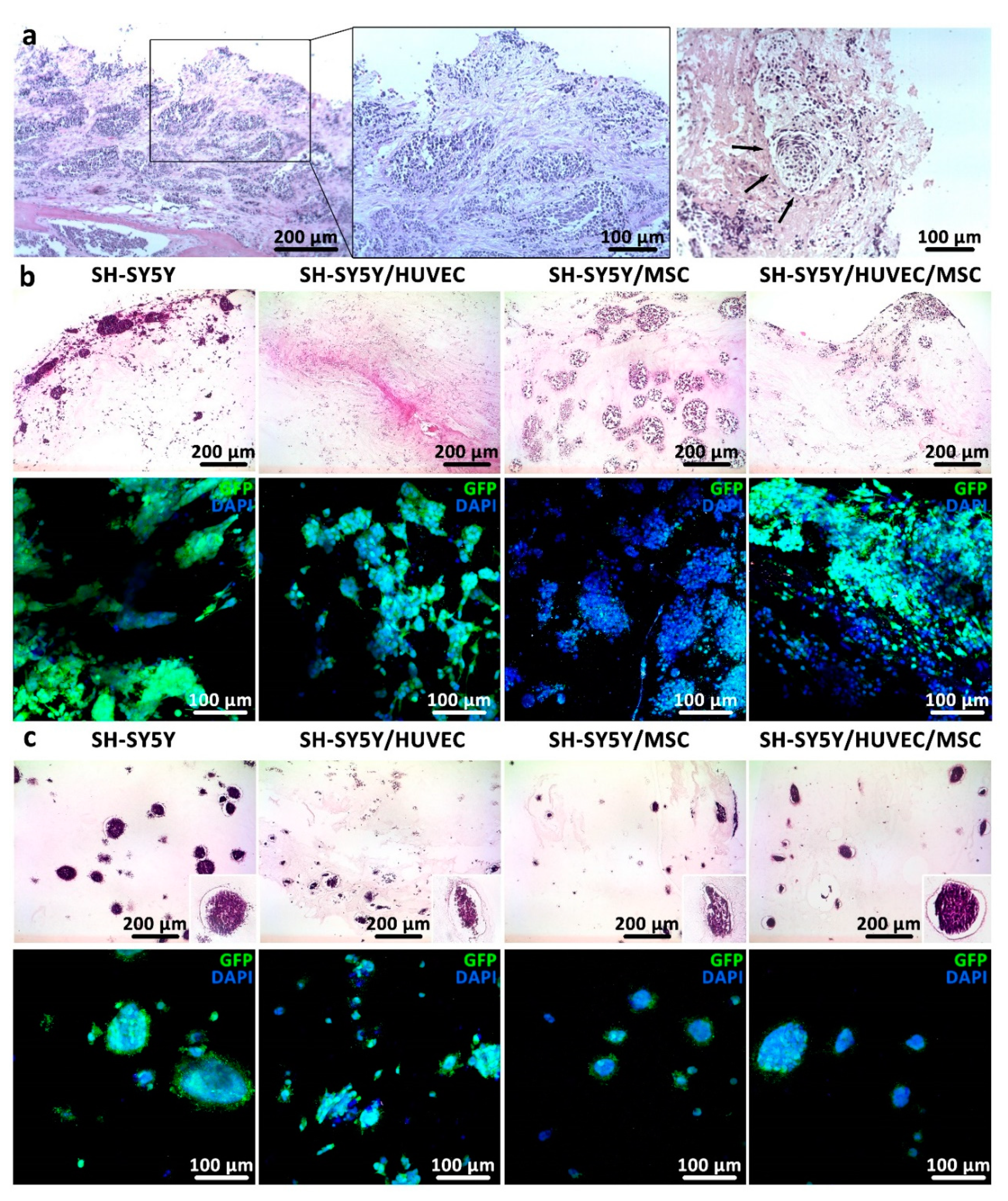 Cancers 11 00180 g004