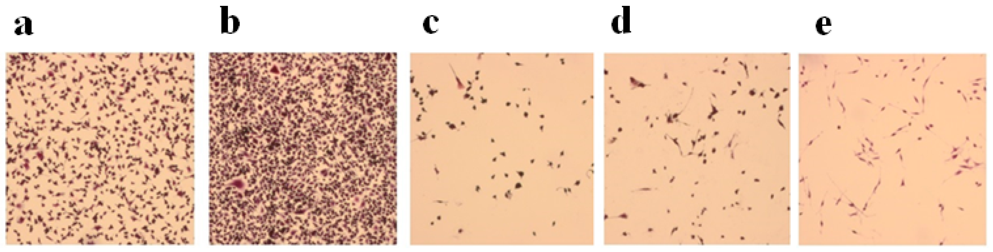 Cancers 11 00206 g002 Cancers 11 00206 g002