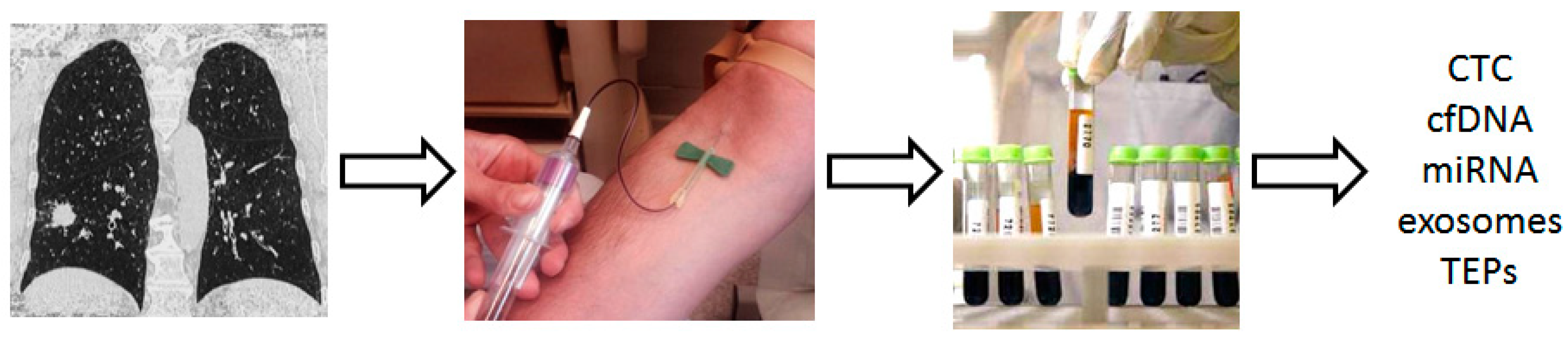 Cancers 11 00212 g005