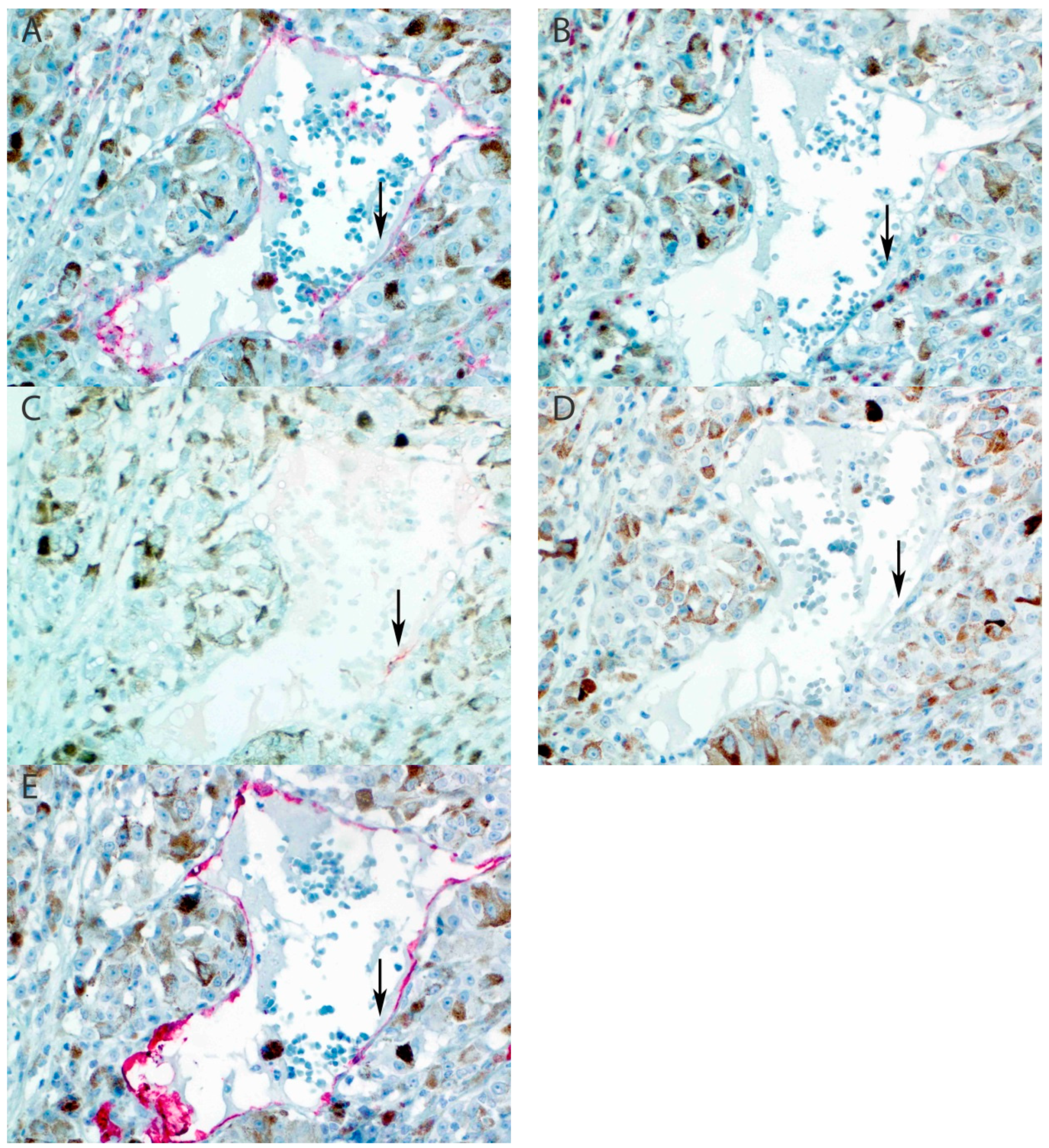 Cancers 11 00228 g002