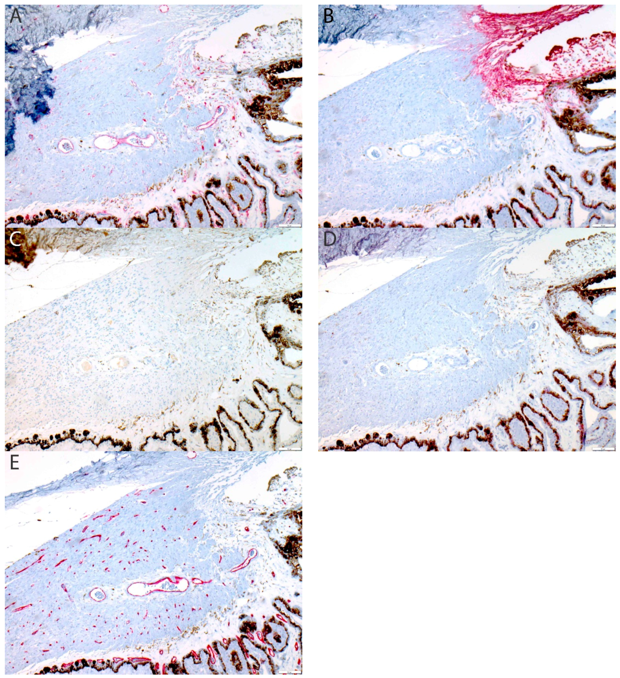 Cancers 11 00228 g0a1