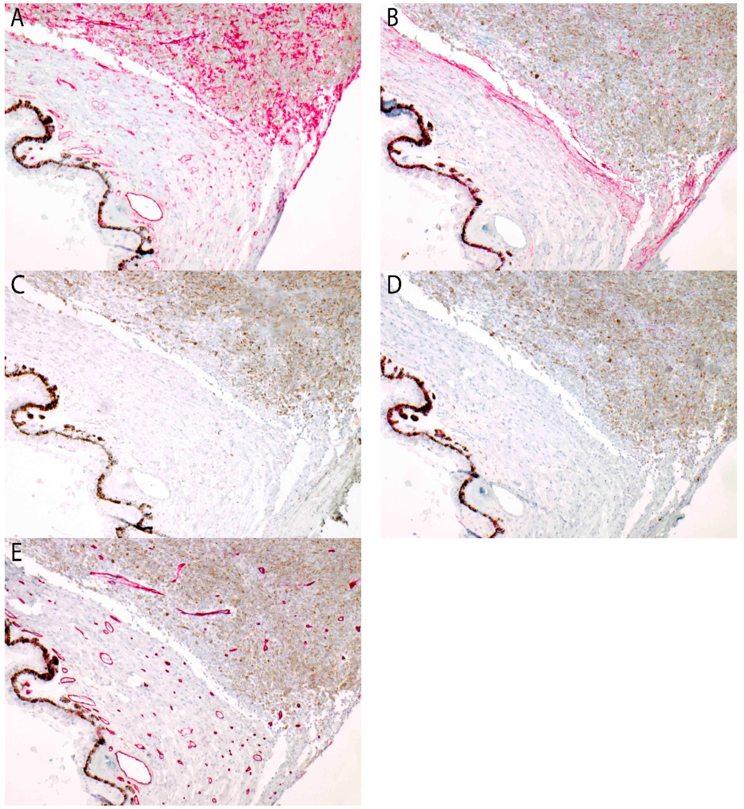 Cancers 11 00228 g0a2