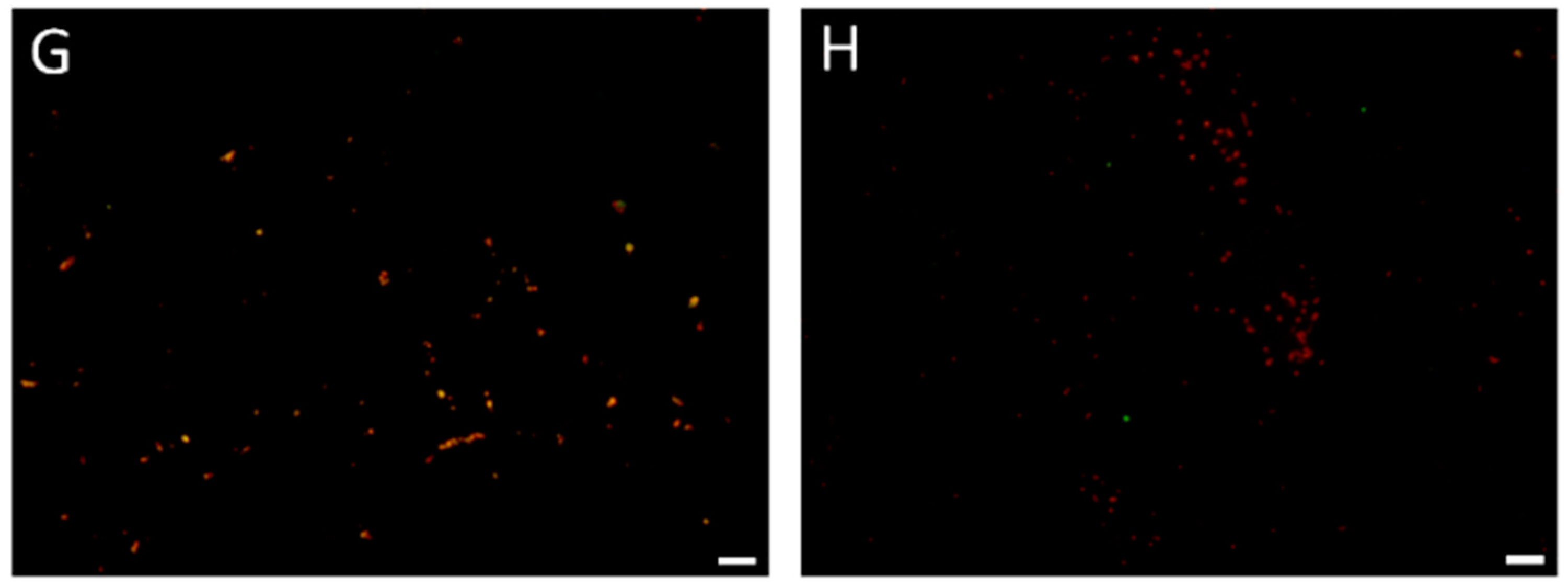 Cancers 11 00229 g005b Cancers 11 00229 g005b