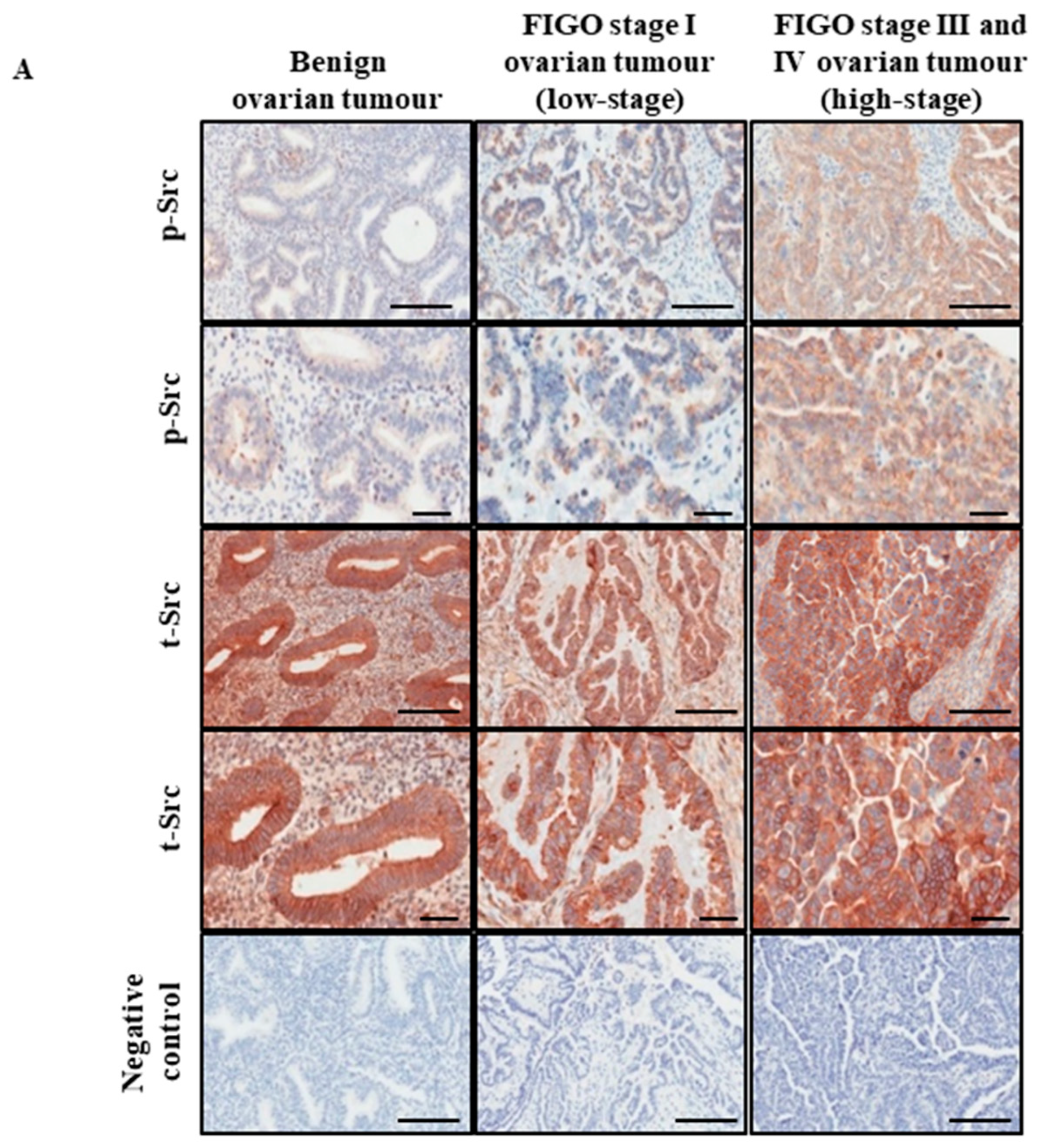 Cancers 11 00243 g001a