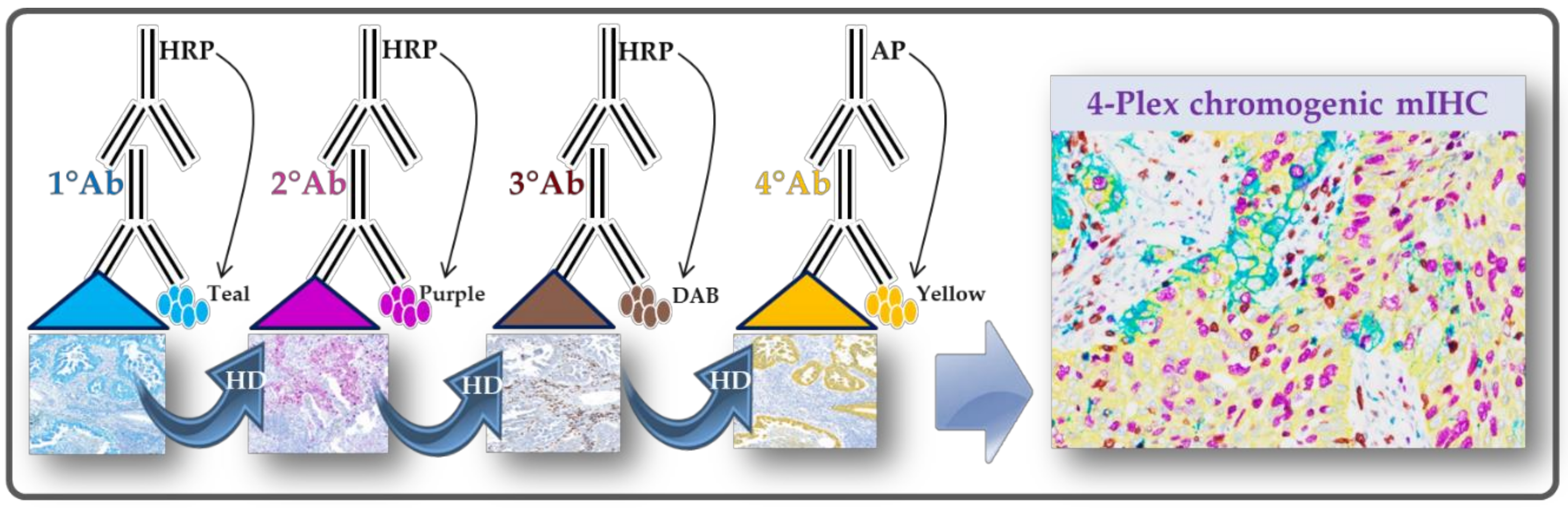 健康・医学 Diagnostic Immunohistochemistry Diagnostic Immunohistochemistry: Theranostic and Genomic