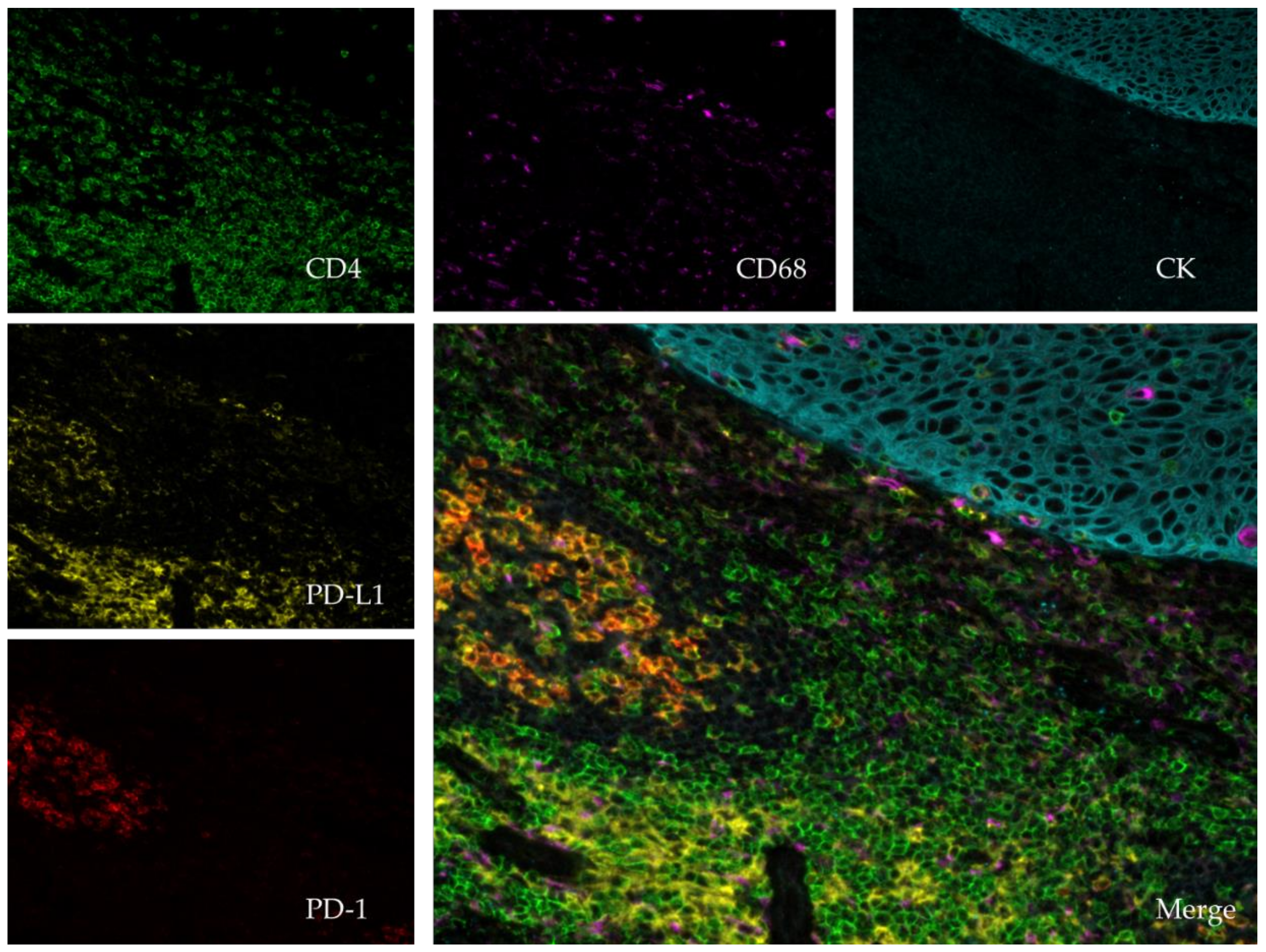 Cancers 11 00283 g002 Cancers 11 00283 g002