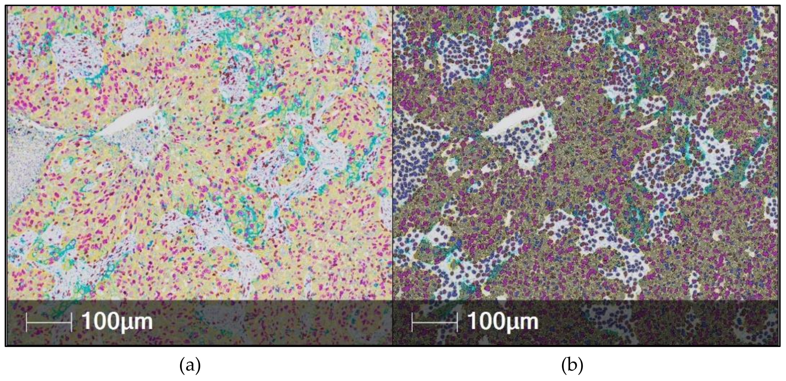 Cancers 11 00283 g006 Cancers 11 00283 g006