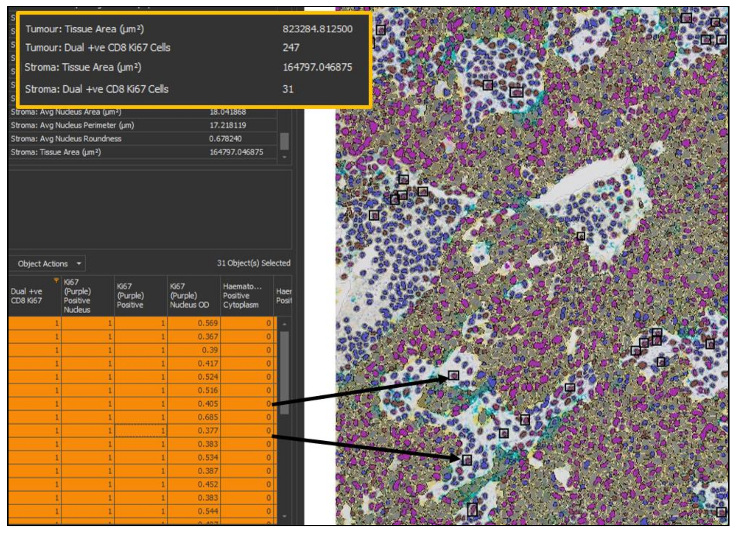 Cancers 11 00283 g007 Cancers 11 00283 g007