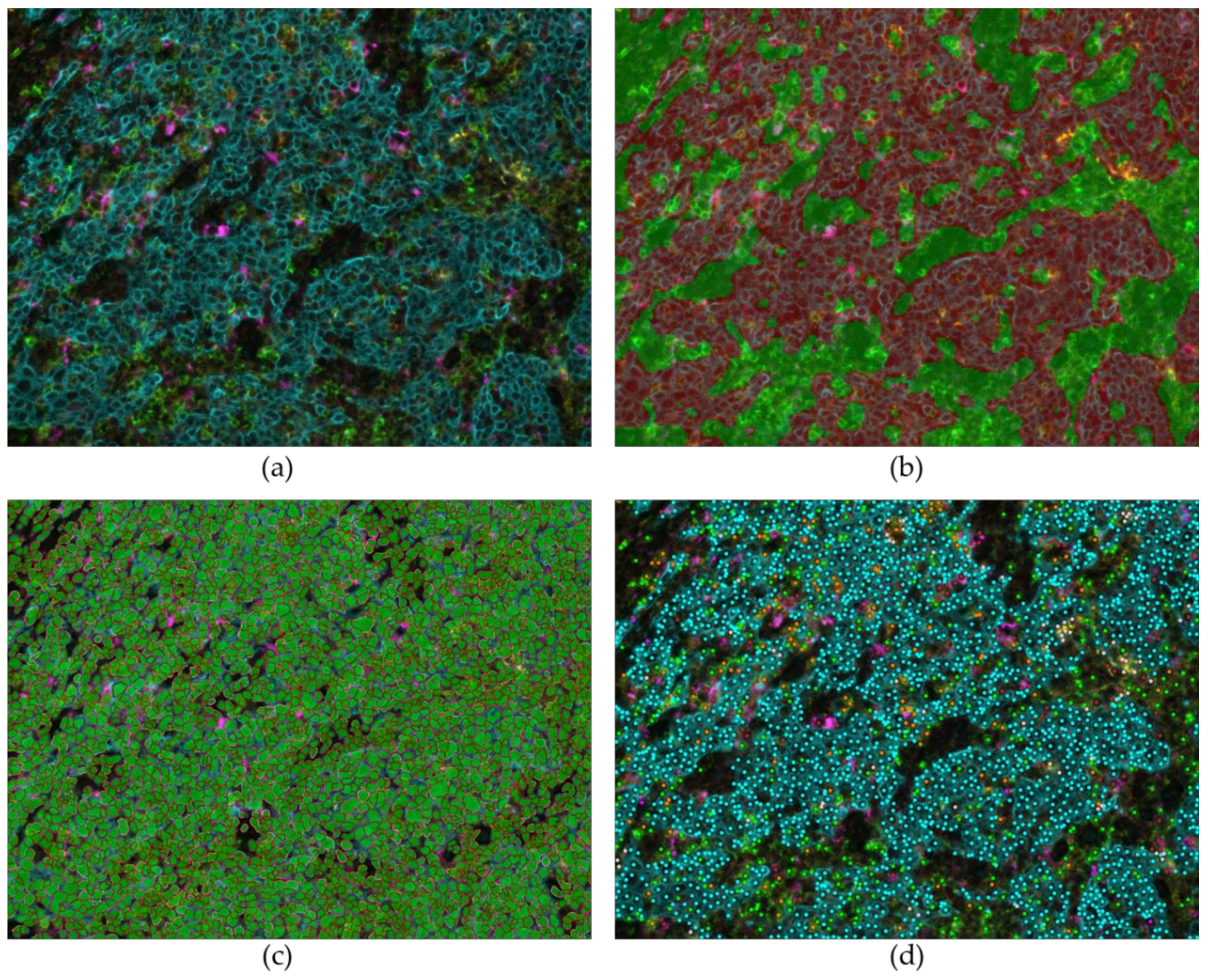 Cancers 11 00283 g008 Cancers 11 00283 g008