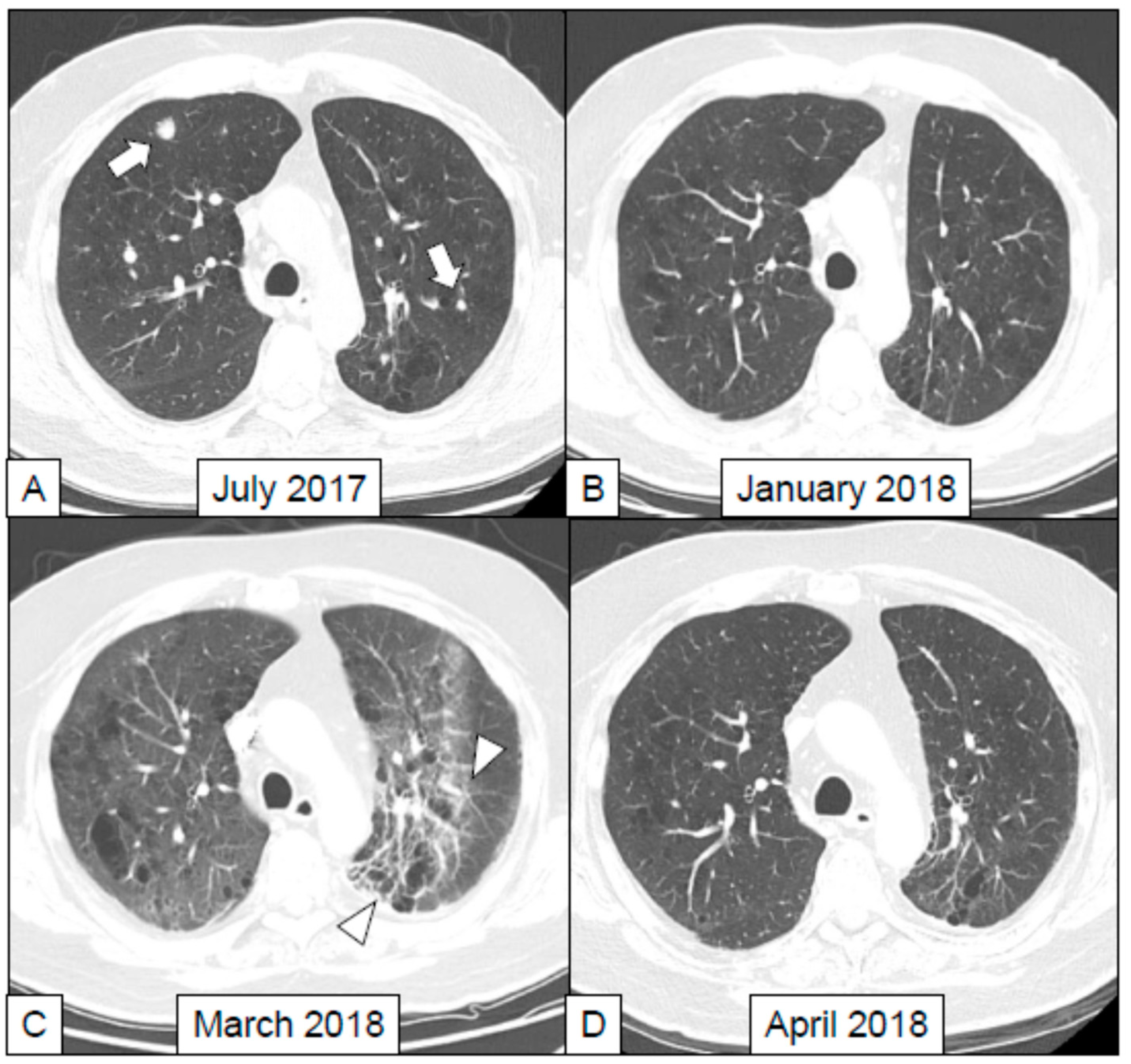 Cancers 11 00305 g002 Cancers 11 00305 g002