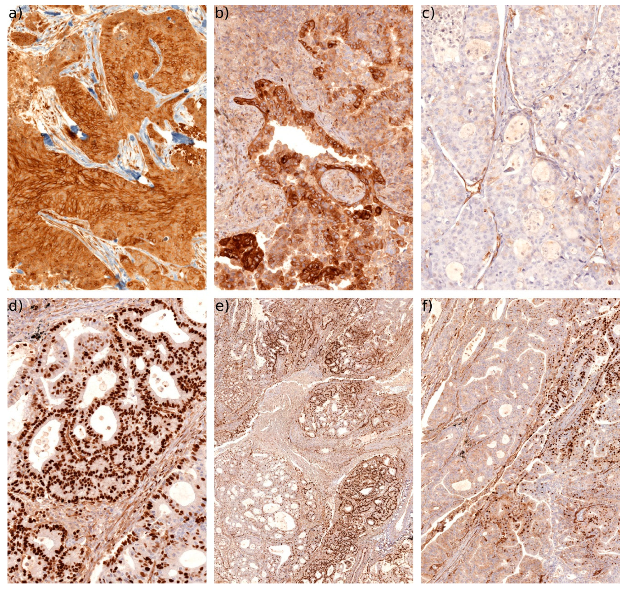 Cancers 11 00320 g005 550