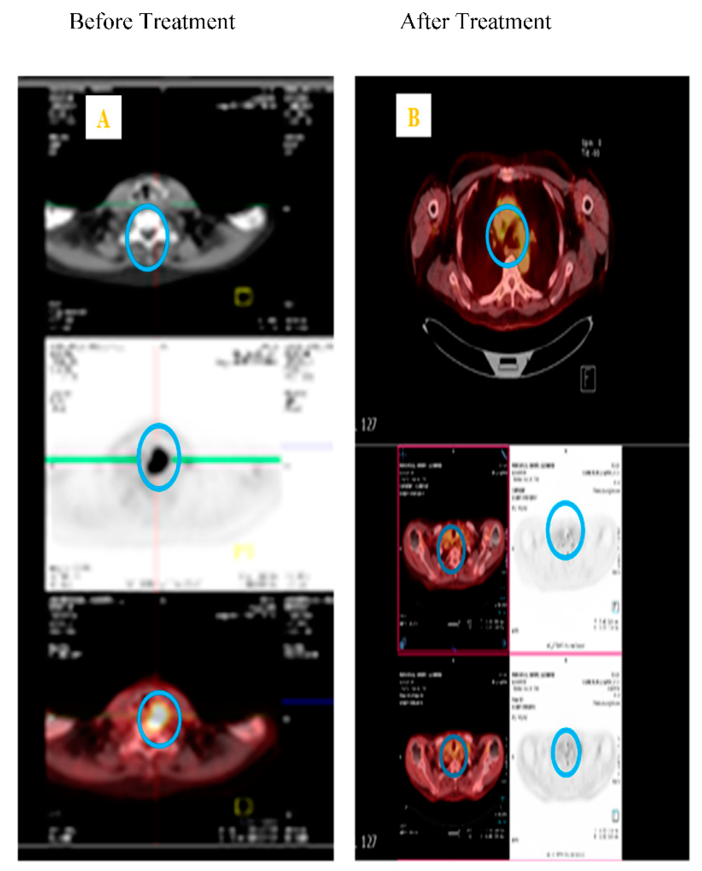 Cancers 11 00367 g002 Cancers 11 00367 g002