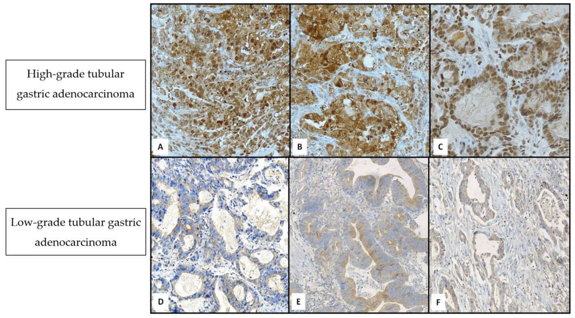 Cancers 11 00389 g001 550