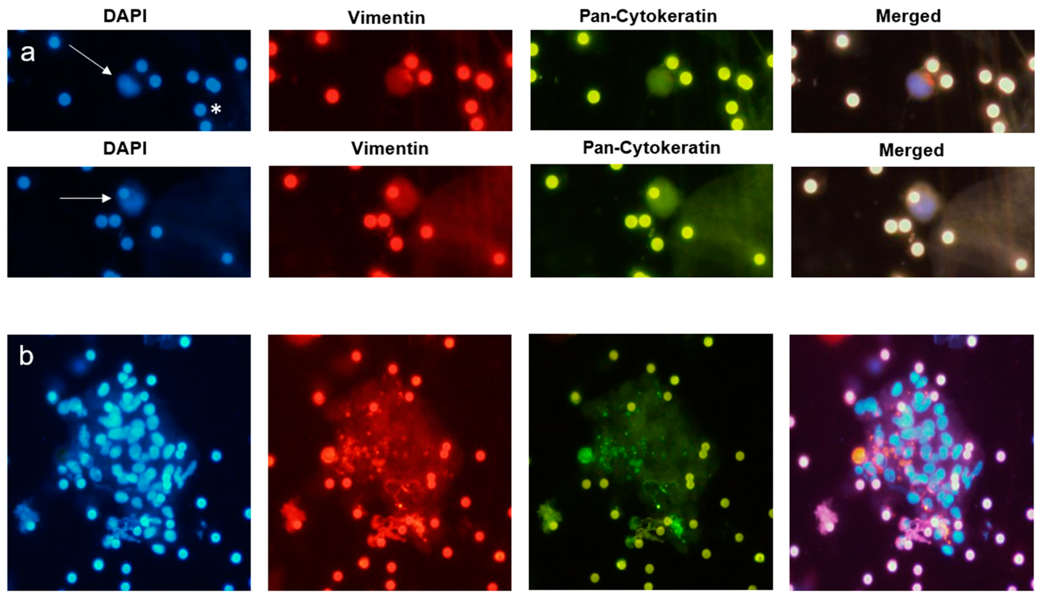 Cancers 11 00397 g004 Cancers 11 00397 g004