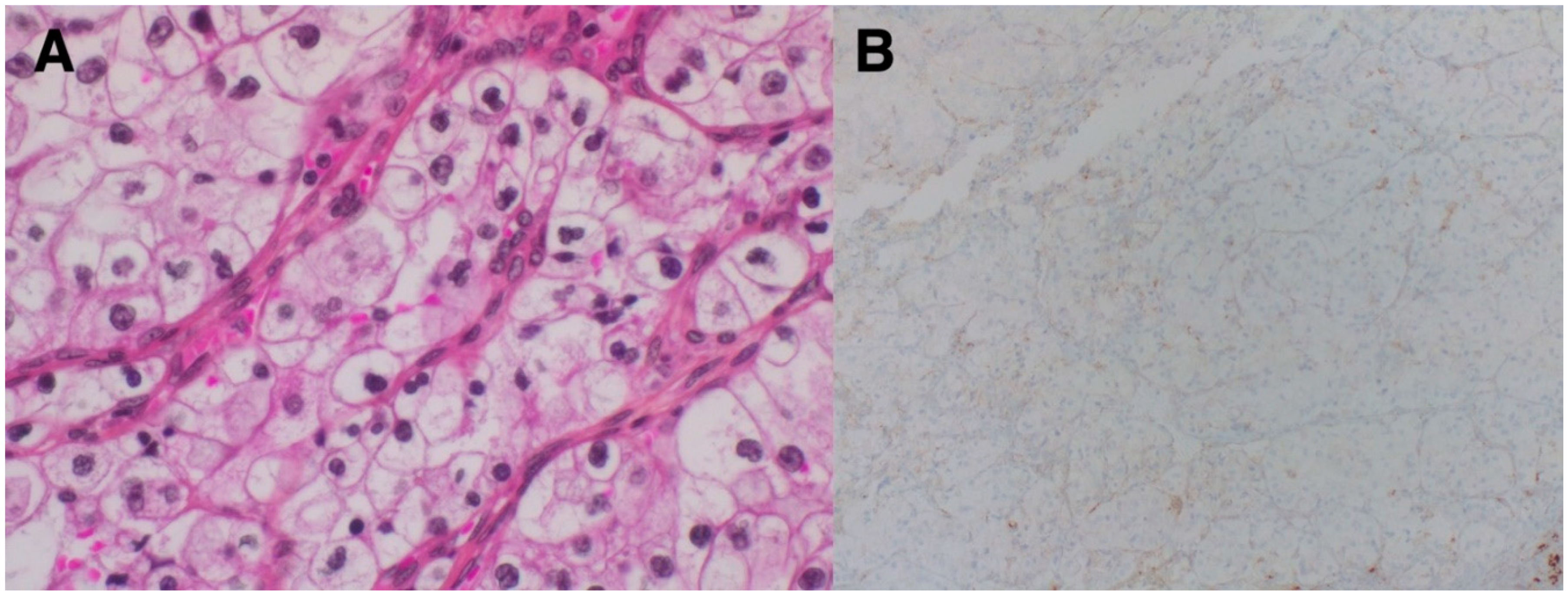 Cancers 11 00422 g002 Cancers 11 00422 g002