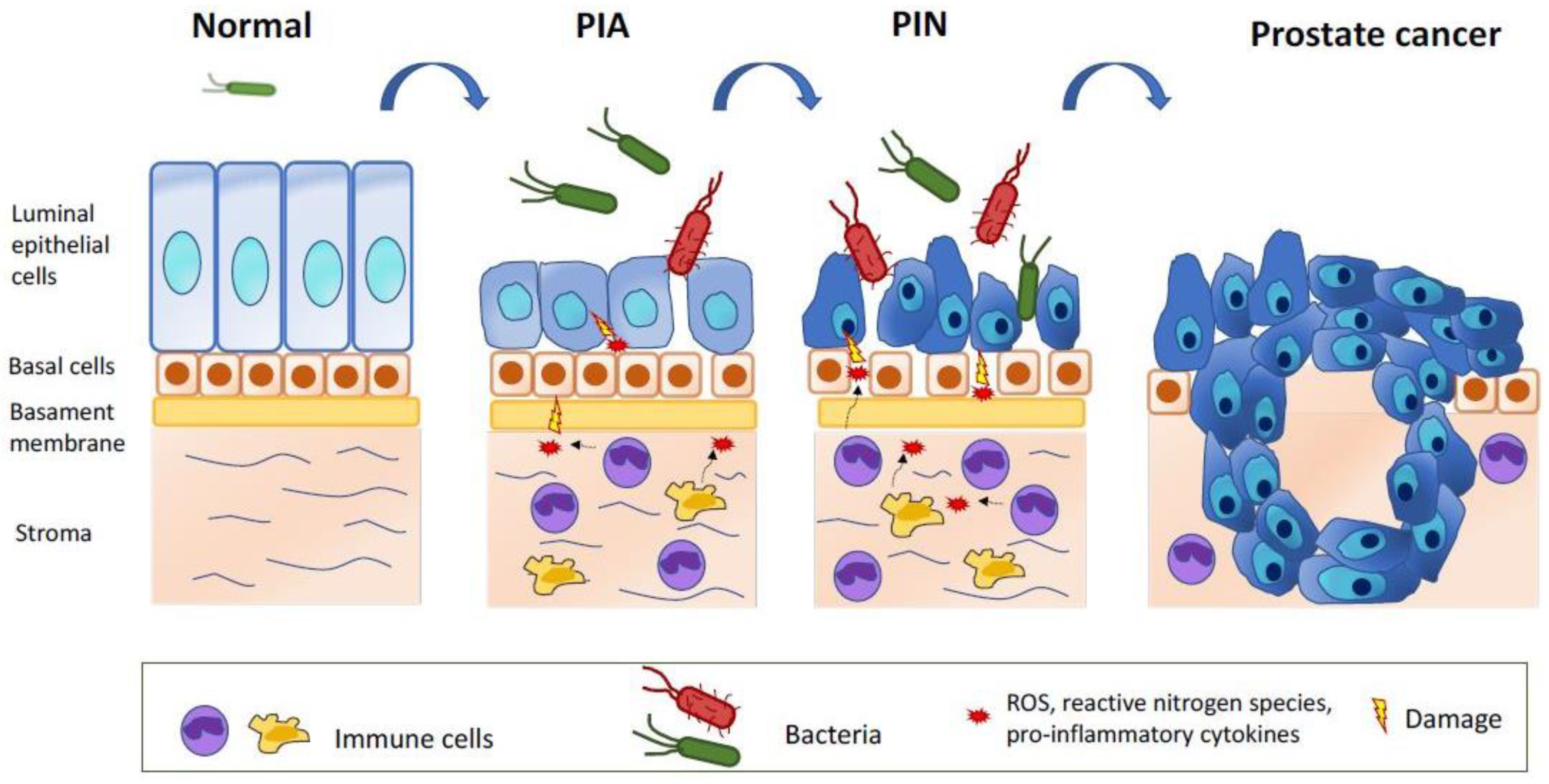 Implicaţiile microbiomului în iniţierea şi promovarea carcinogenezei
