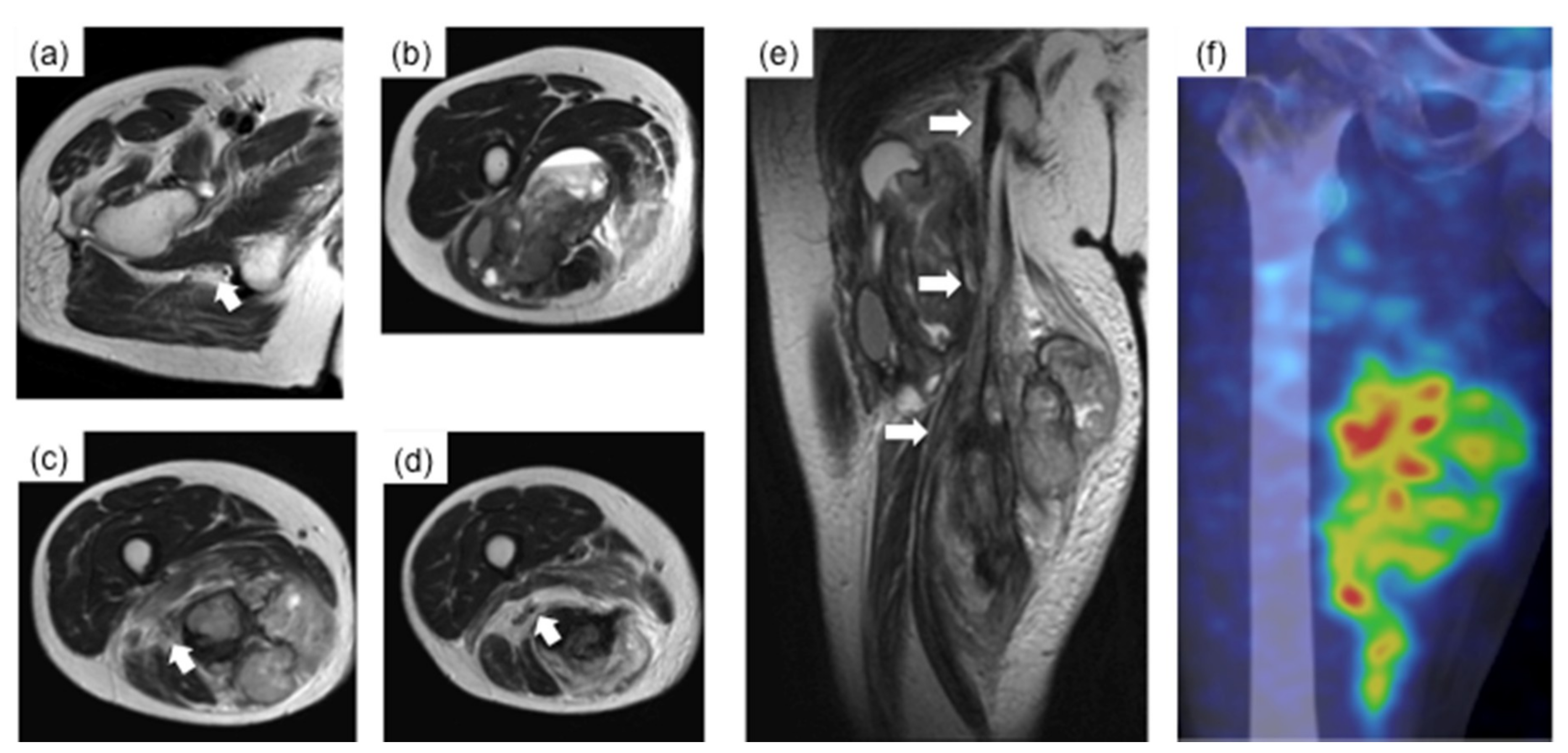 Cancers 11 00506 g001