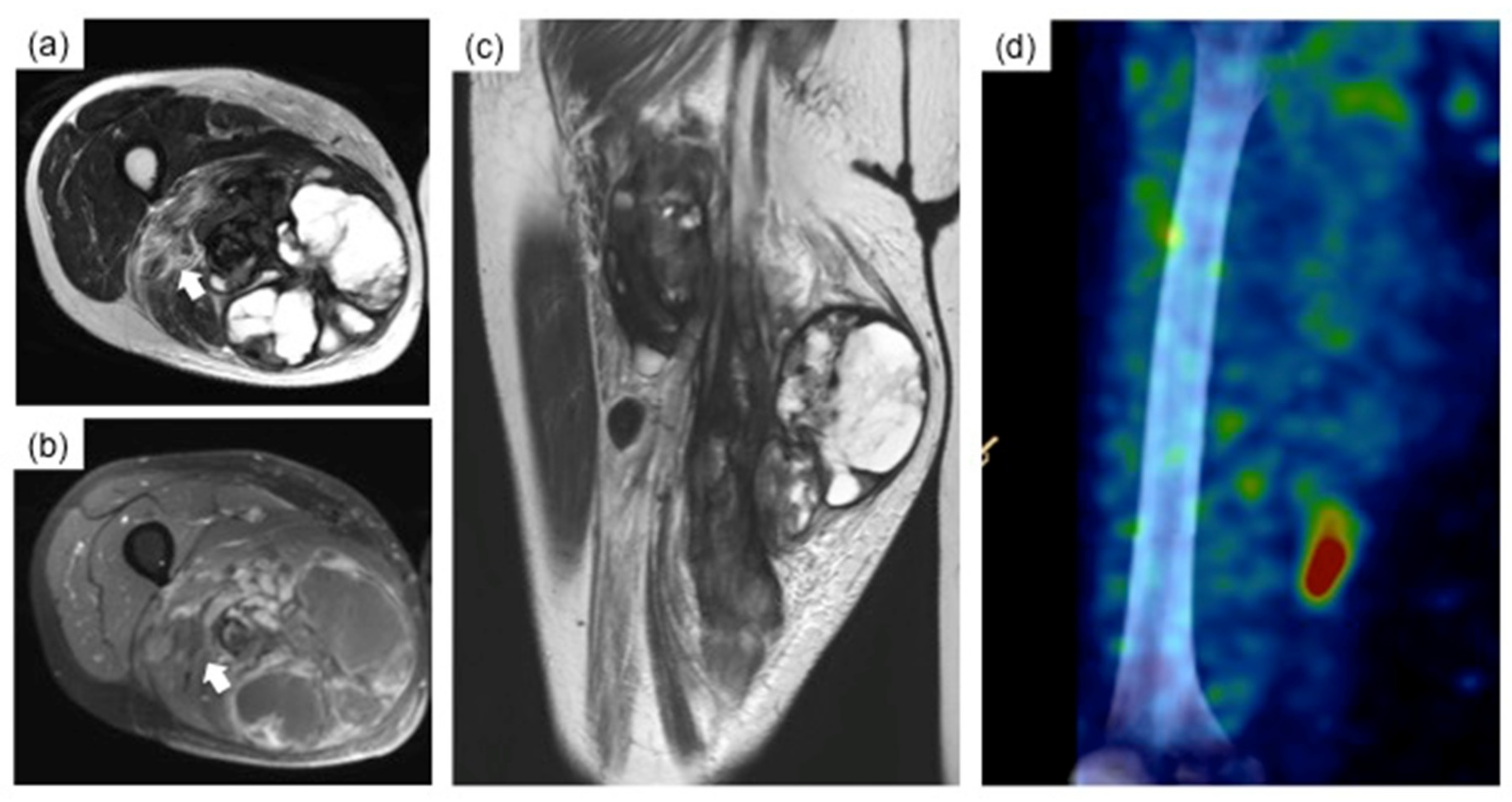 Cancers 11 00506 g003