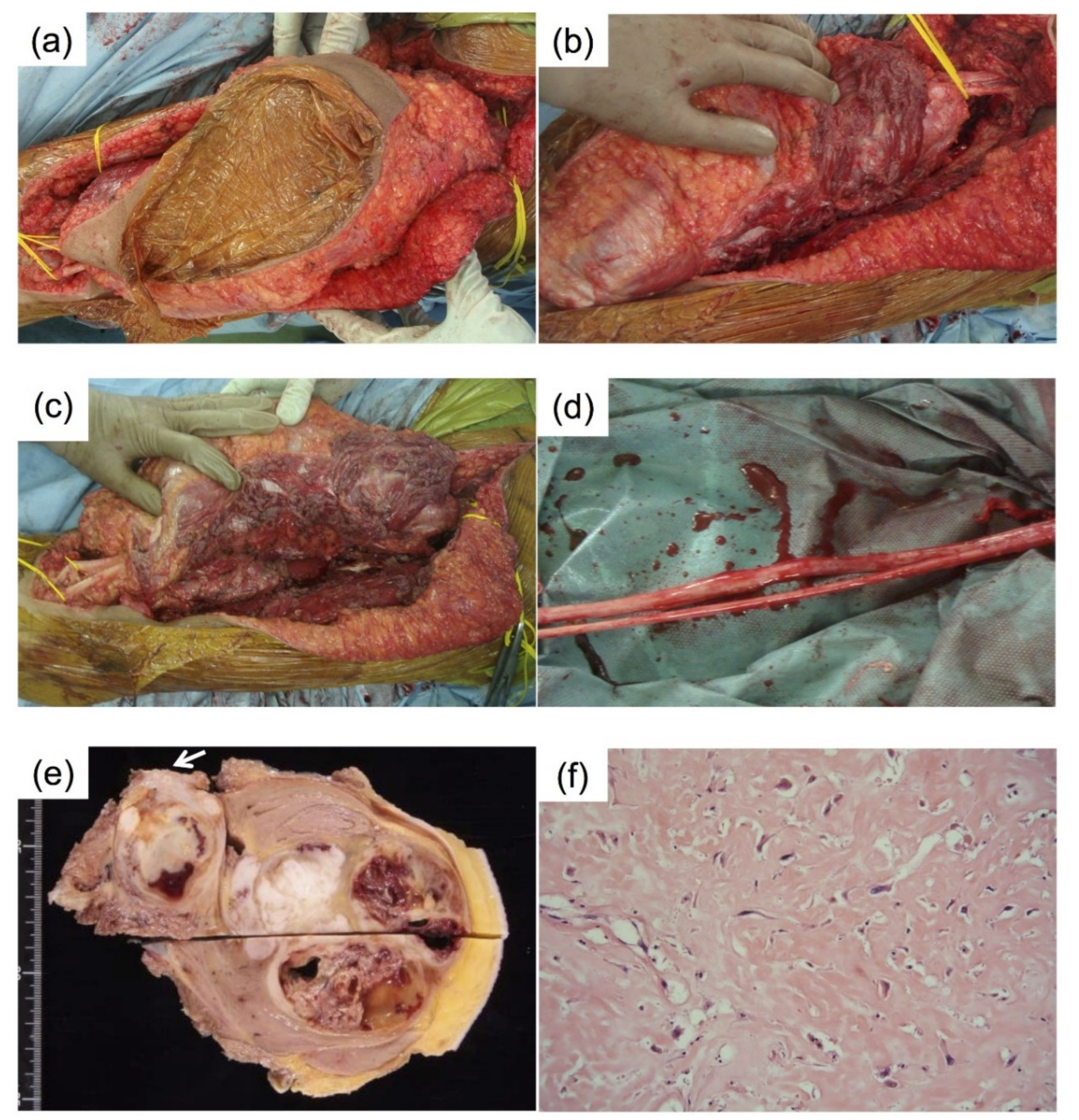 Cancers 11 00506 g004