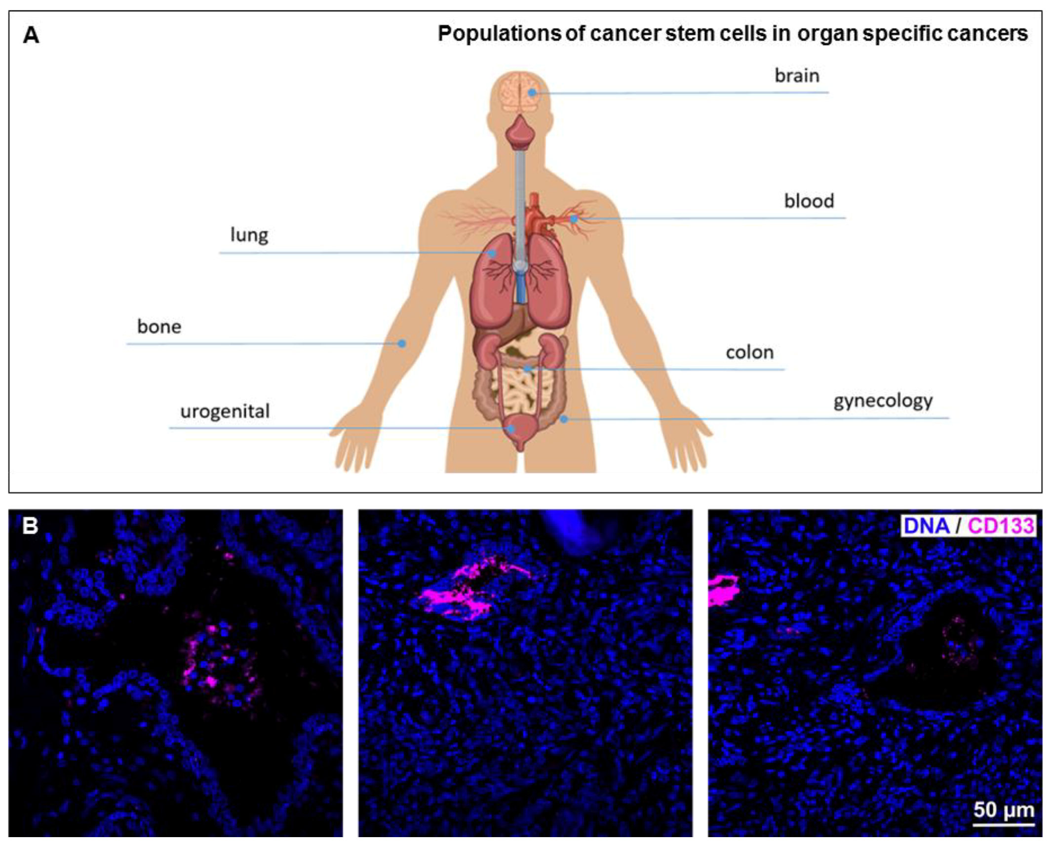 Cancers 11 00655 g003