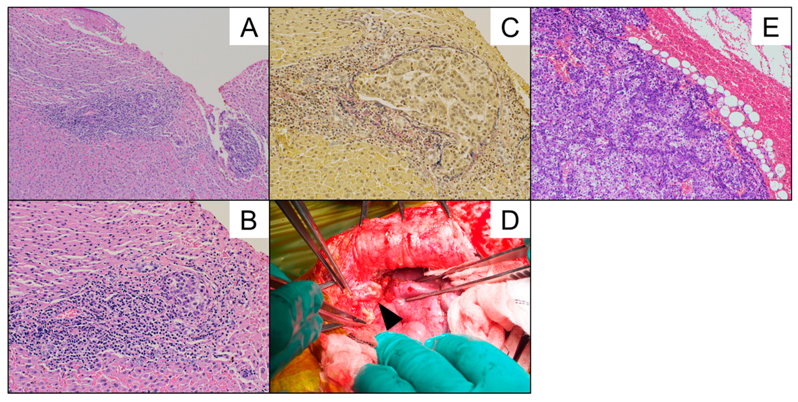 Cancers 11 00730 g002
