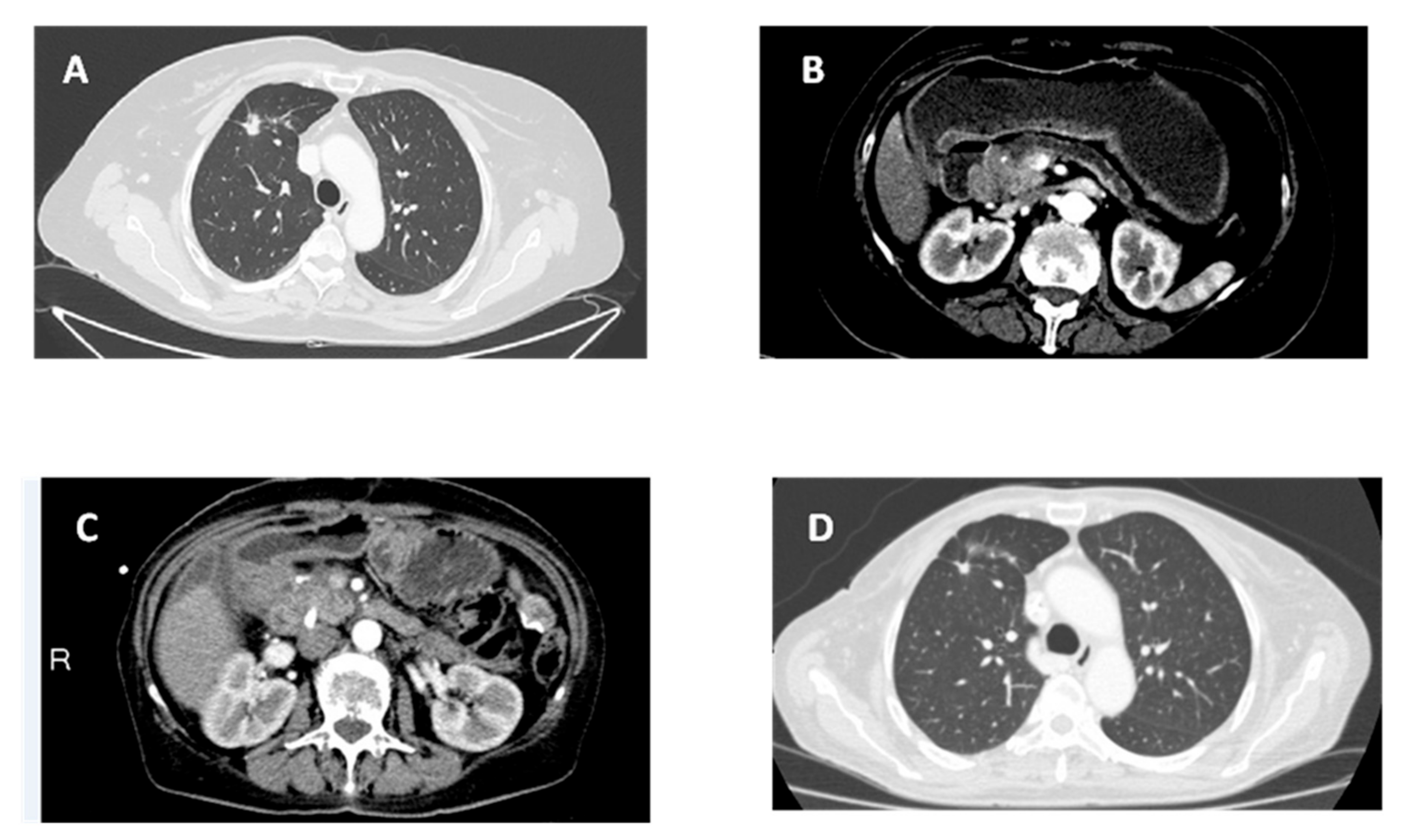 Cancers 11 00749 g001