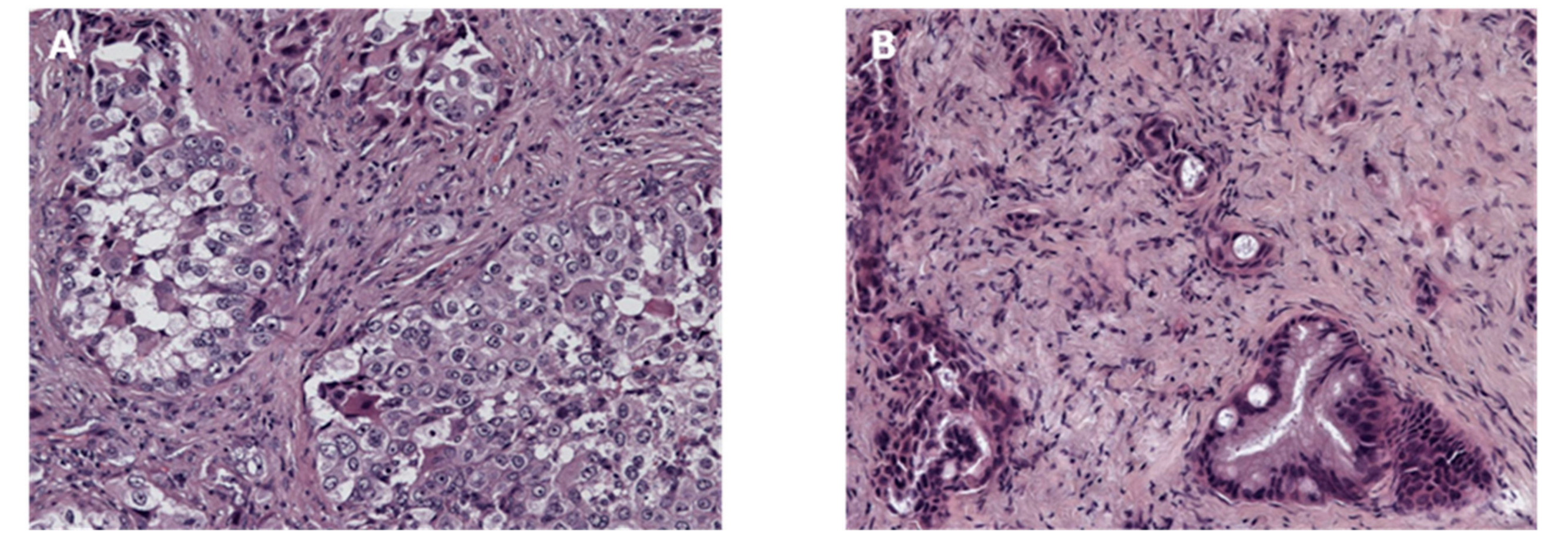 Cancers 11 00749 g002