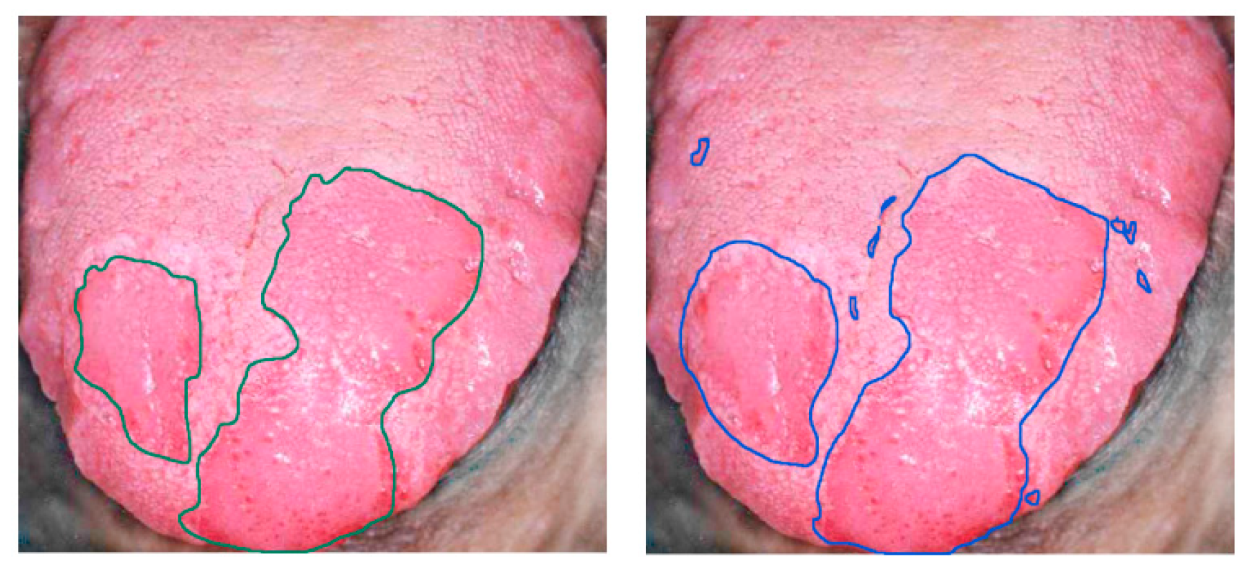 Cancers 11 00756 g010 Cancers 11 00756 g010