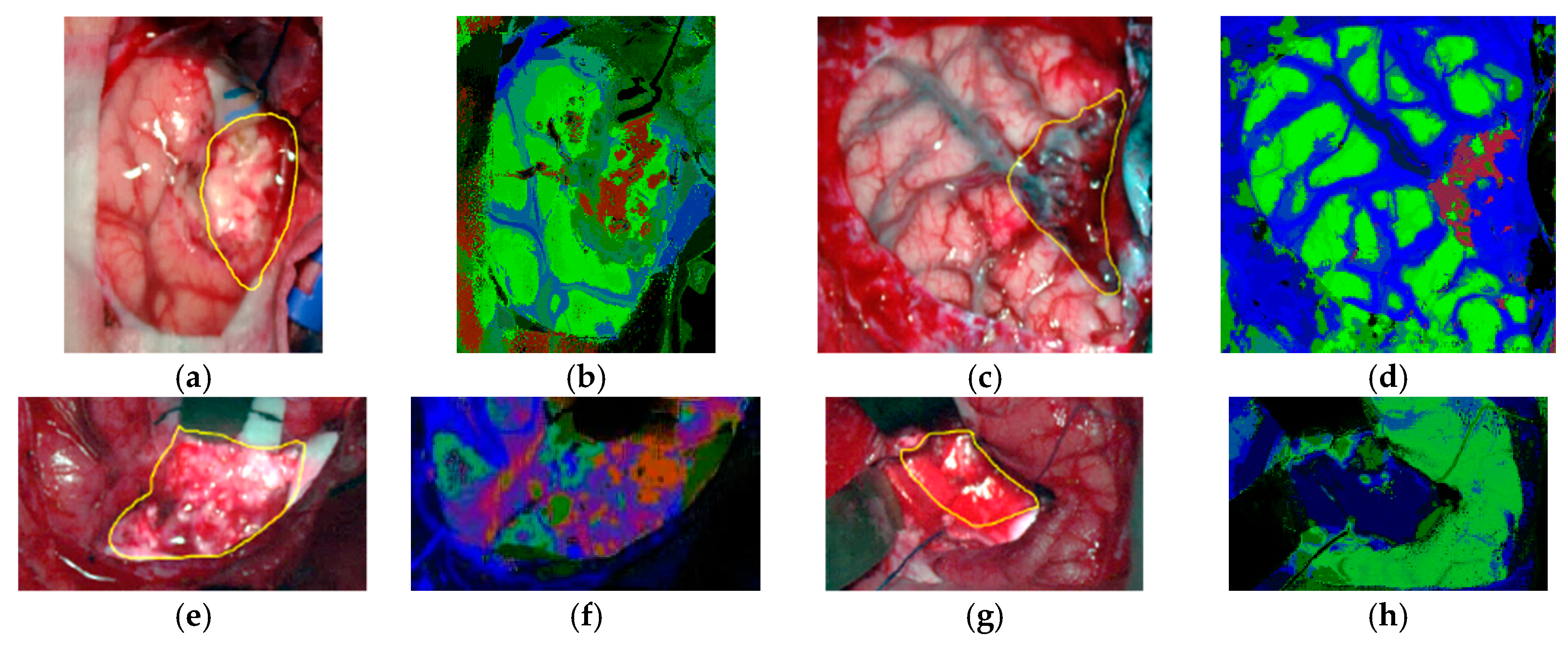 Cancers 11 00756 g012 Cancers 11 00756 g012