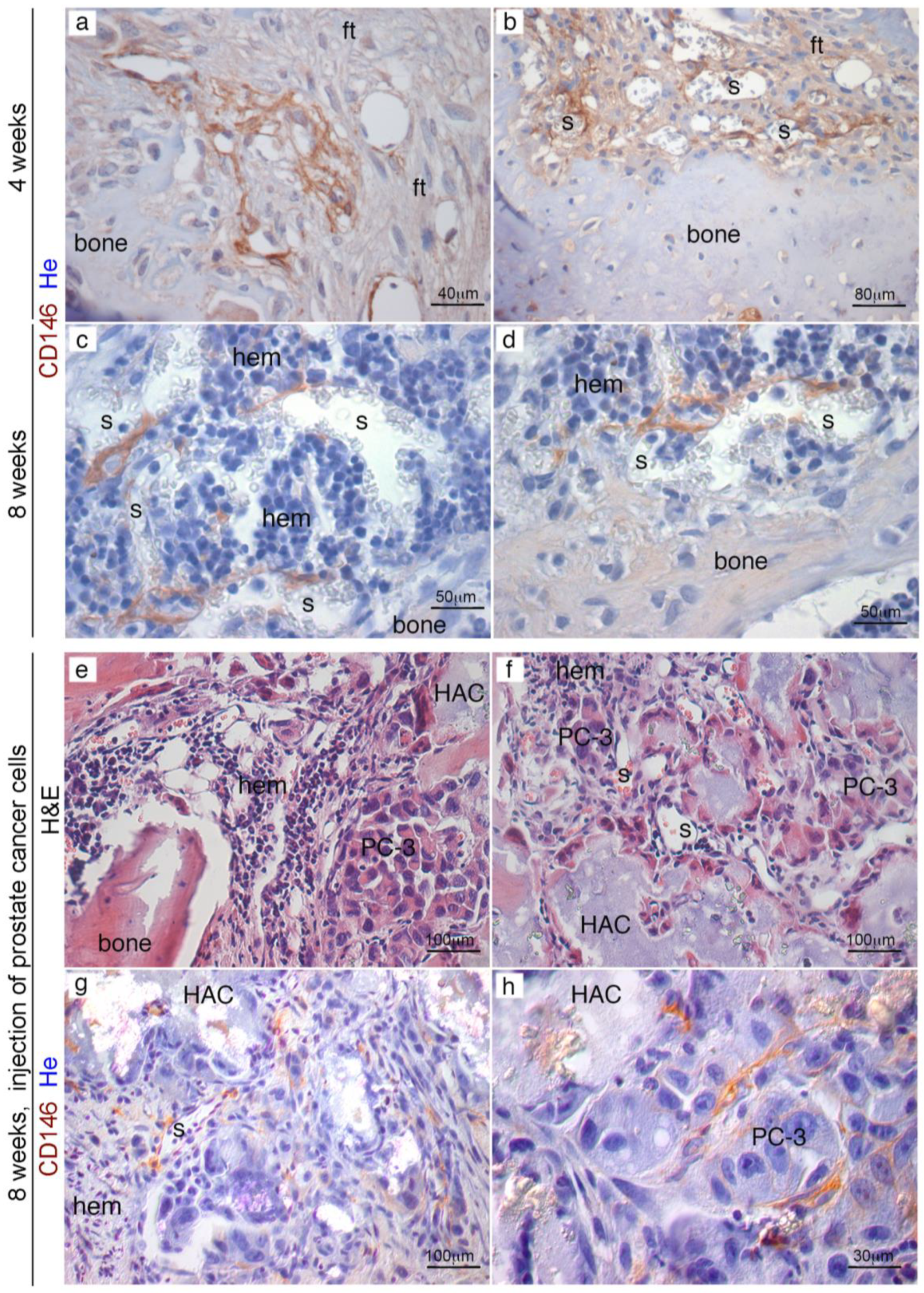 Cancers 11 00763 g005 Cancers 11 00763 g005