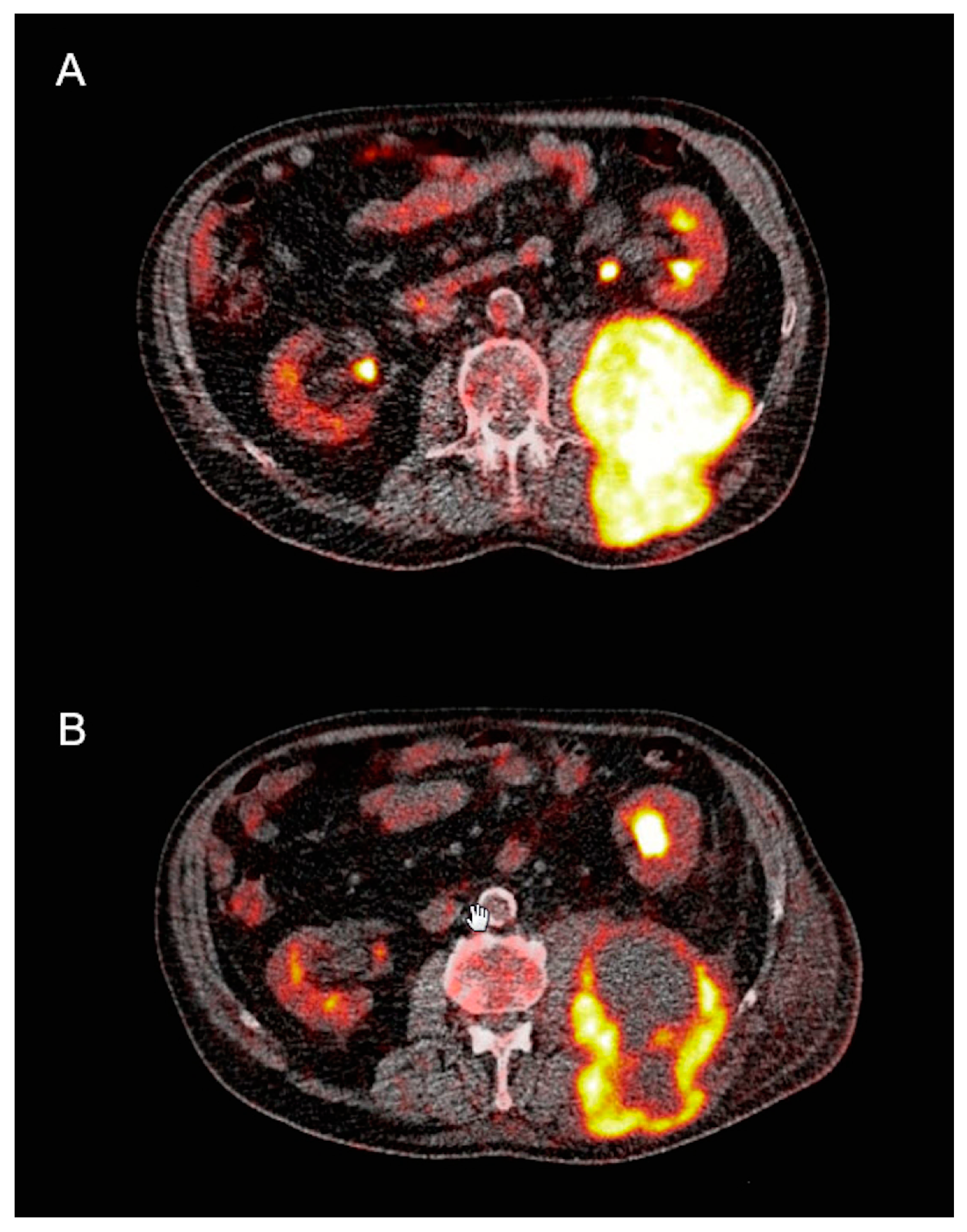 Cancers 11 00790 g002 Cancers 11 00790 g002
